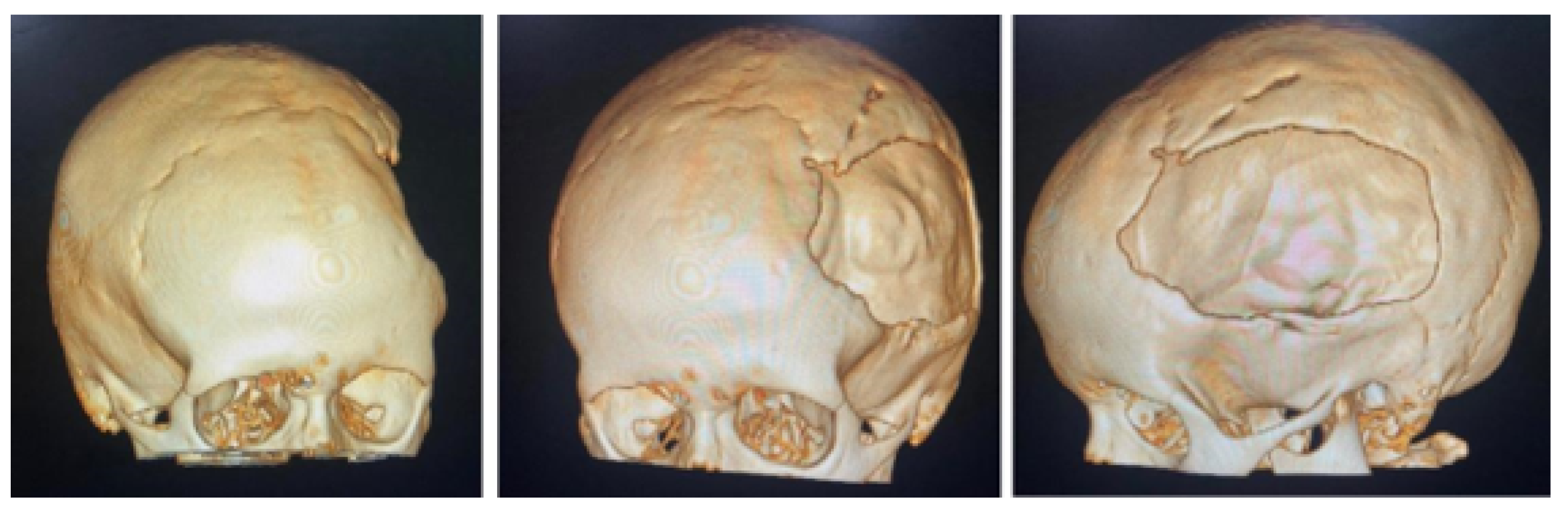 Preprints 168065 g011