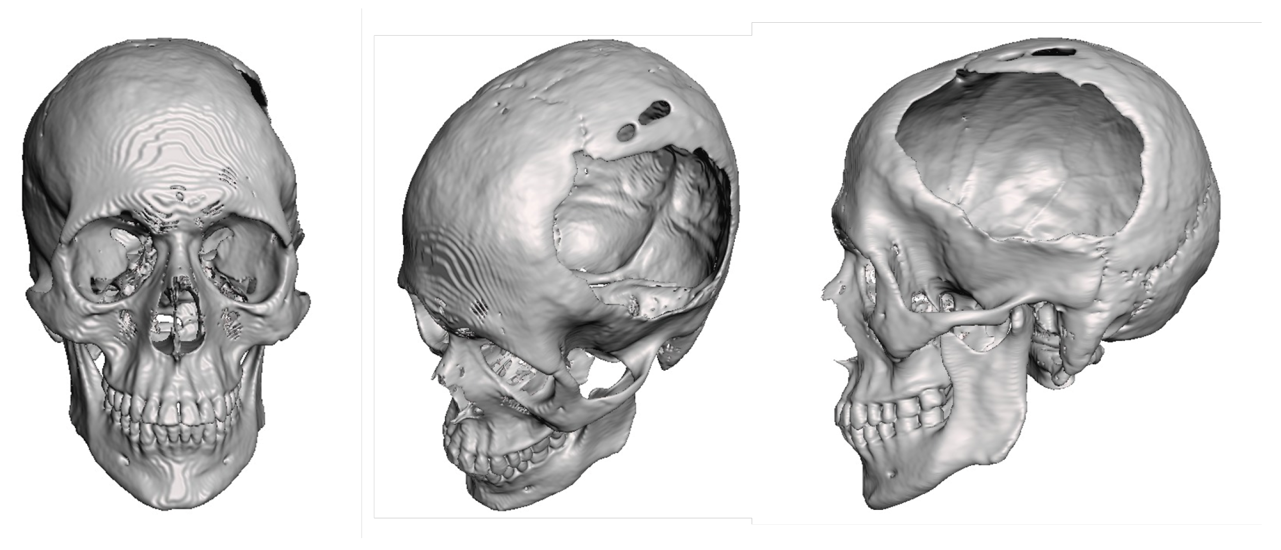 Preprints 168065 g012