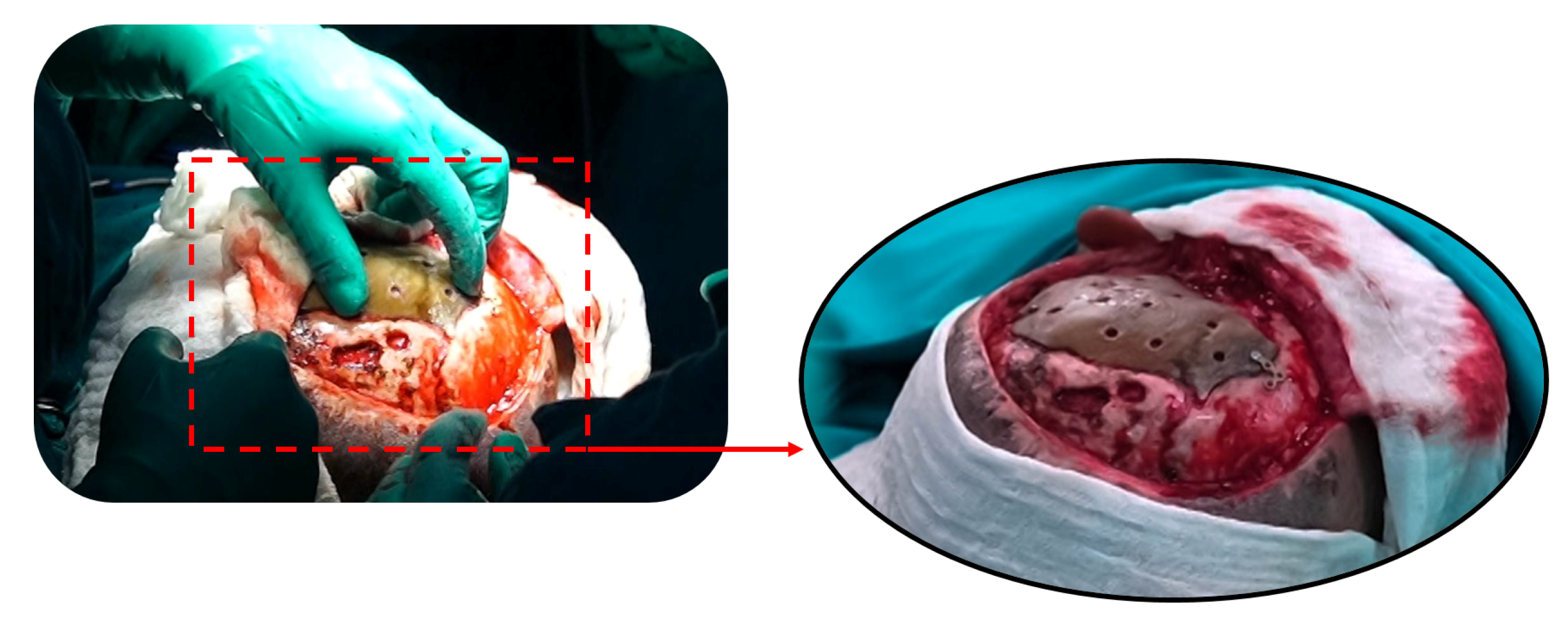 Preprints 168065 g014