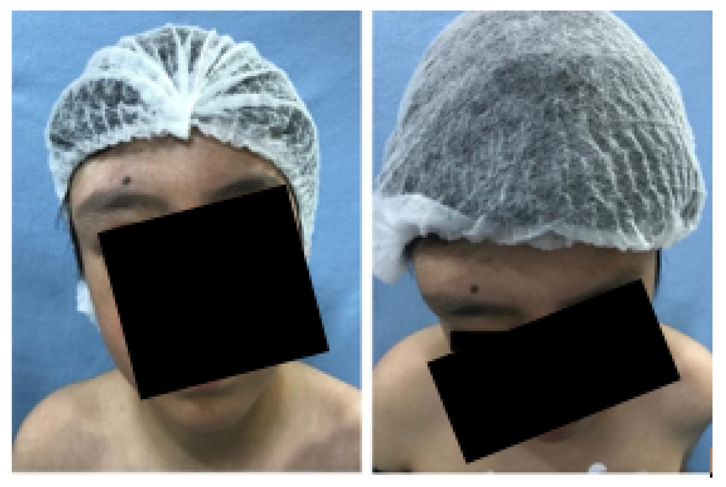 Preprints 168065 g017