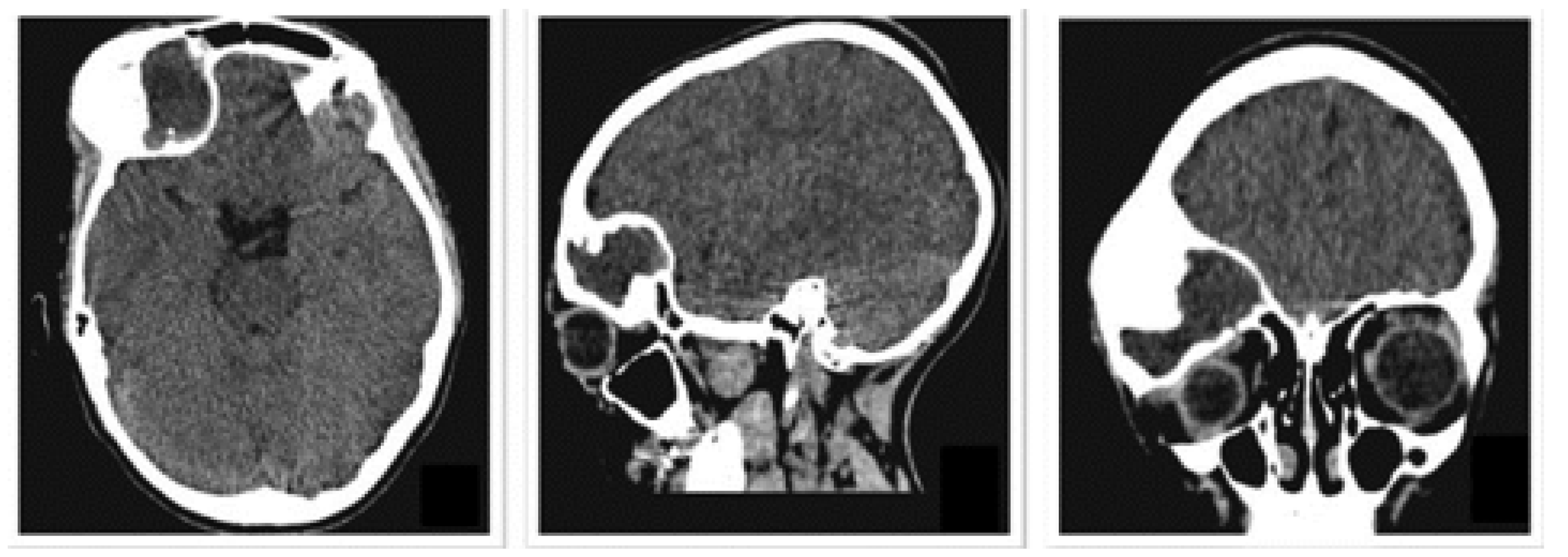 Preprints 168065 g018