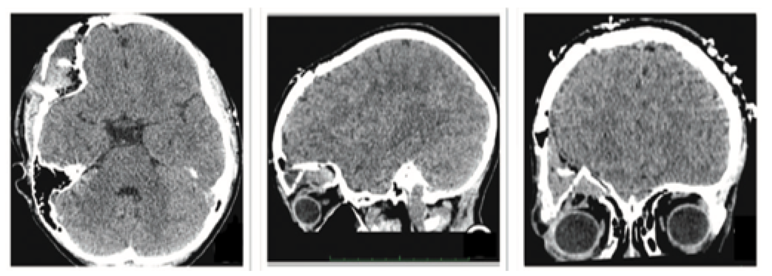 Preprints 168065 g022