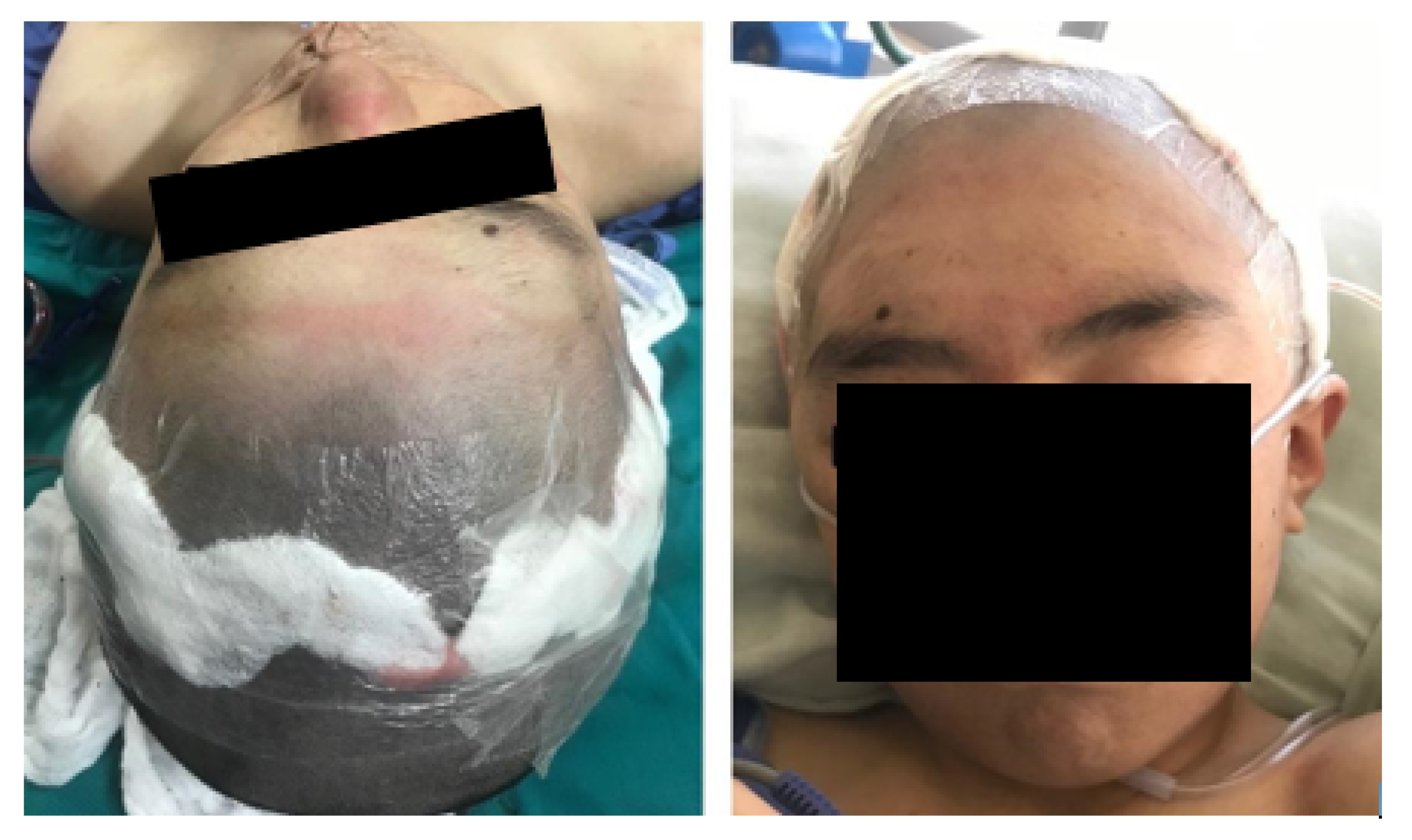 Preprints 168065 g023