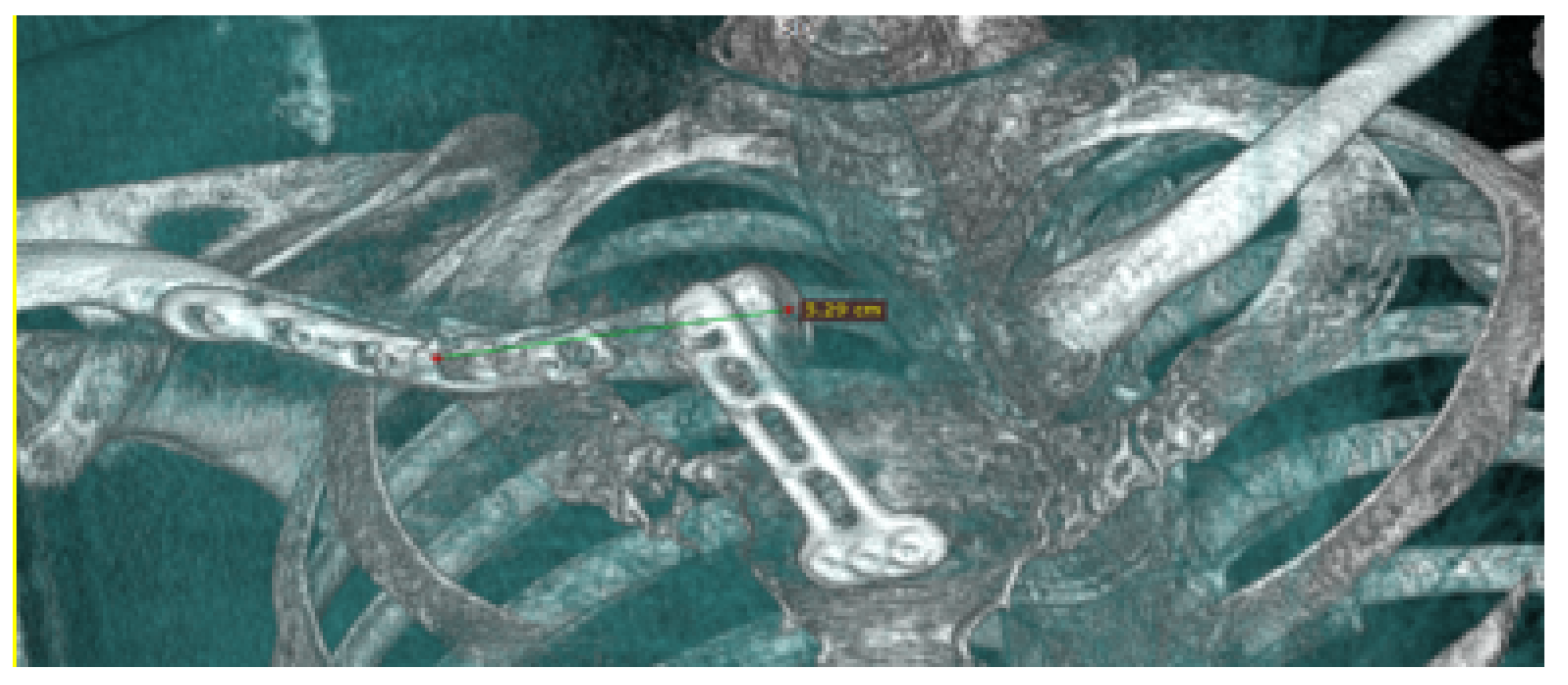 Preprints 168065 g031