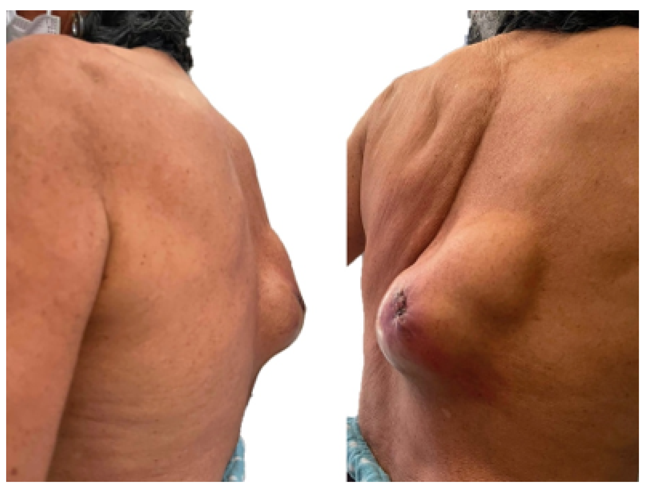 Preprints 168065 g032