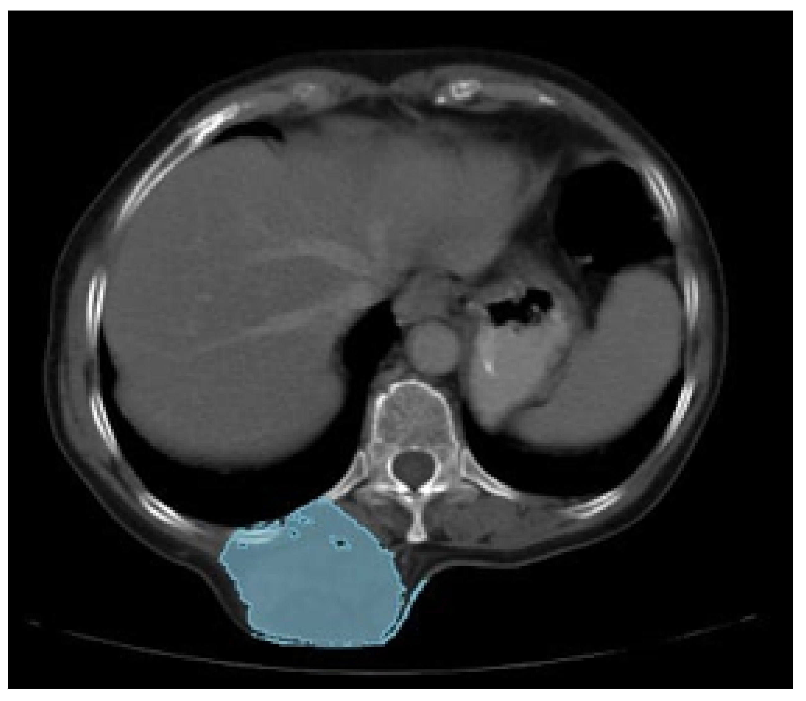 Preprints 168065 g033