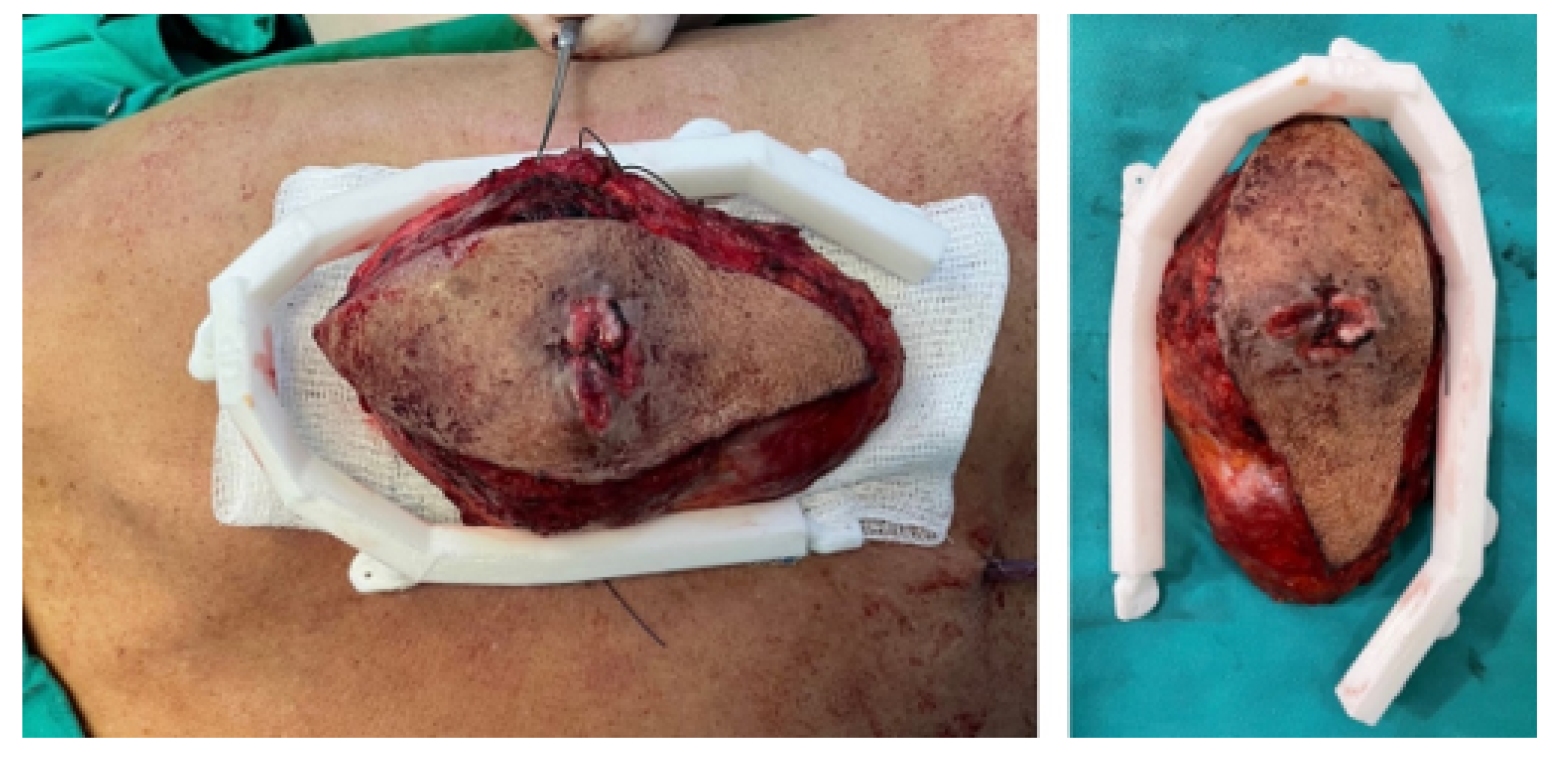 Preprints 168065 g036