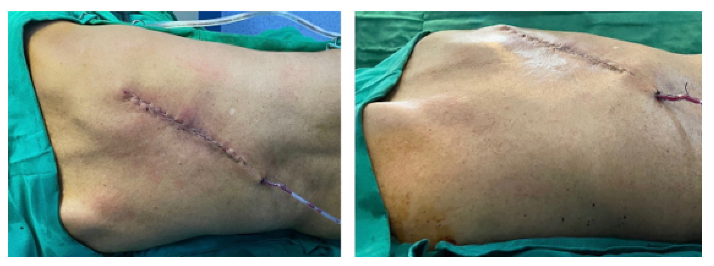 Preprints 168065 g037