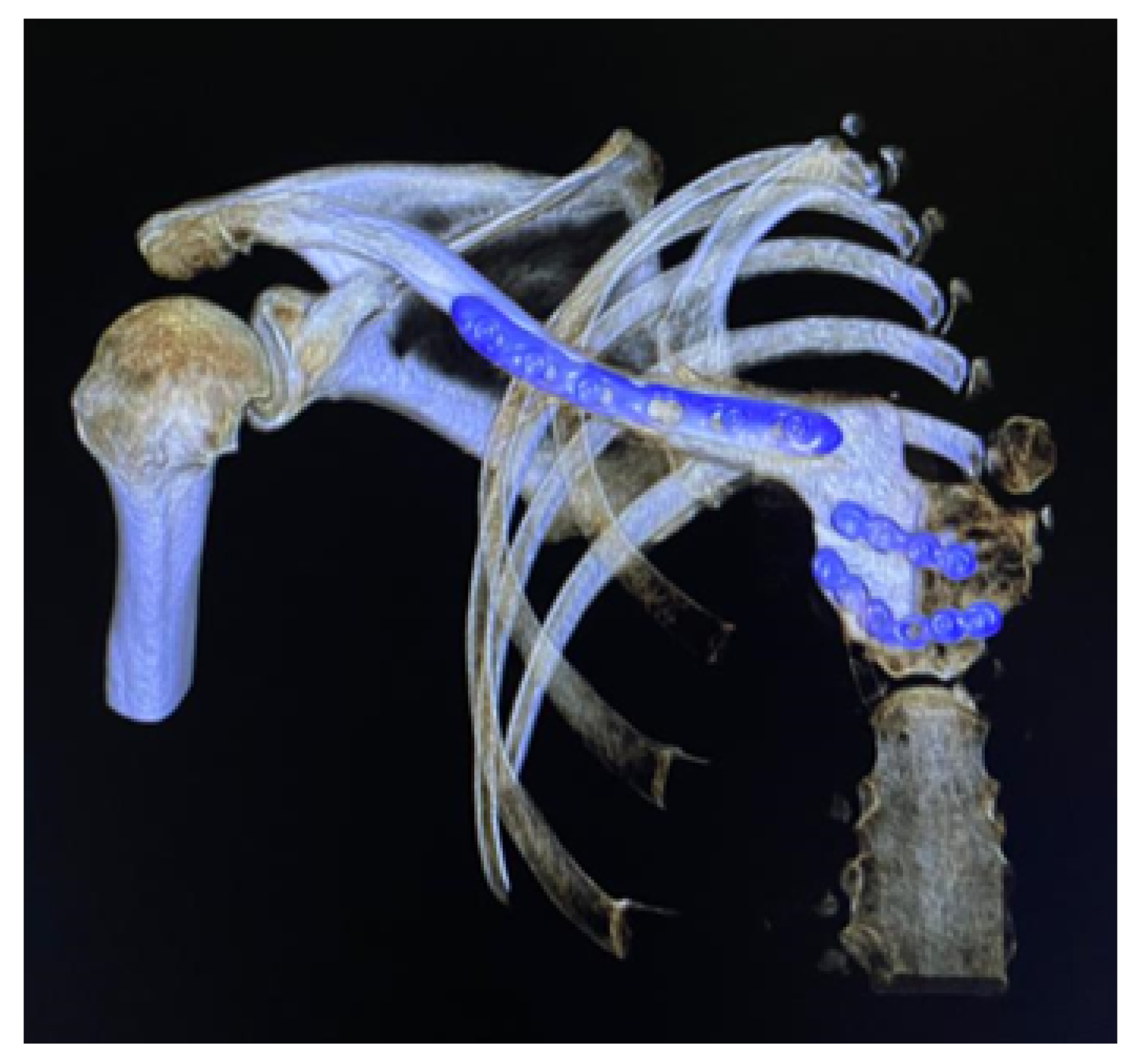 Preprints 168065 g042