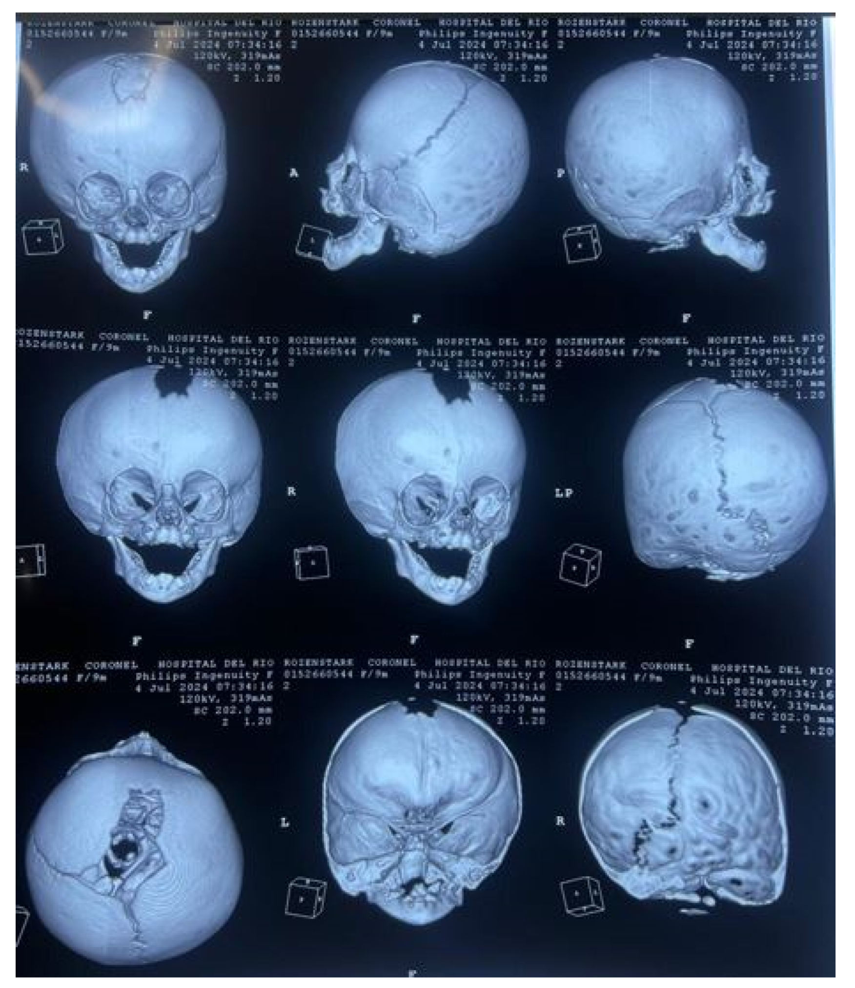Preprints 168065 g043