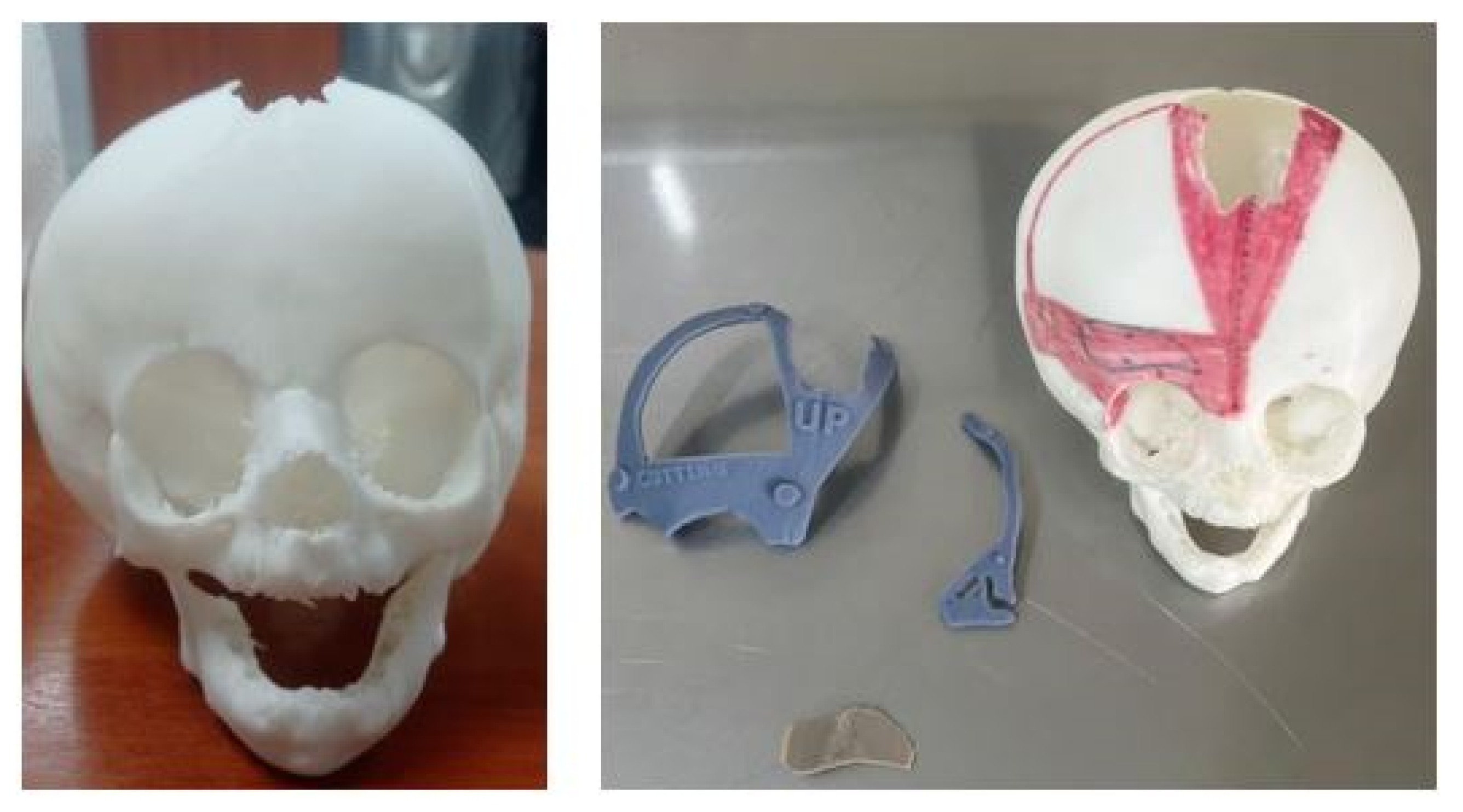 Preprints 168065 g044