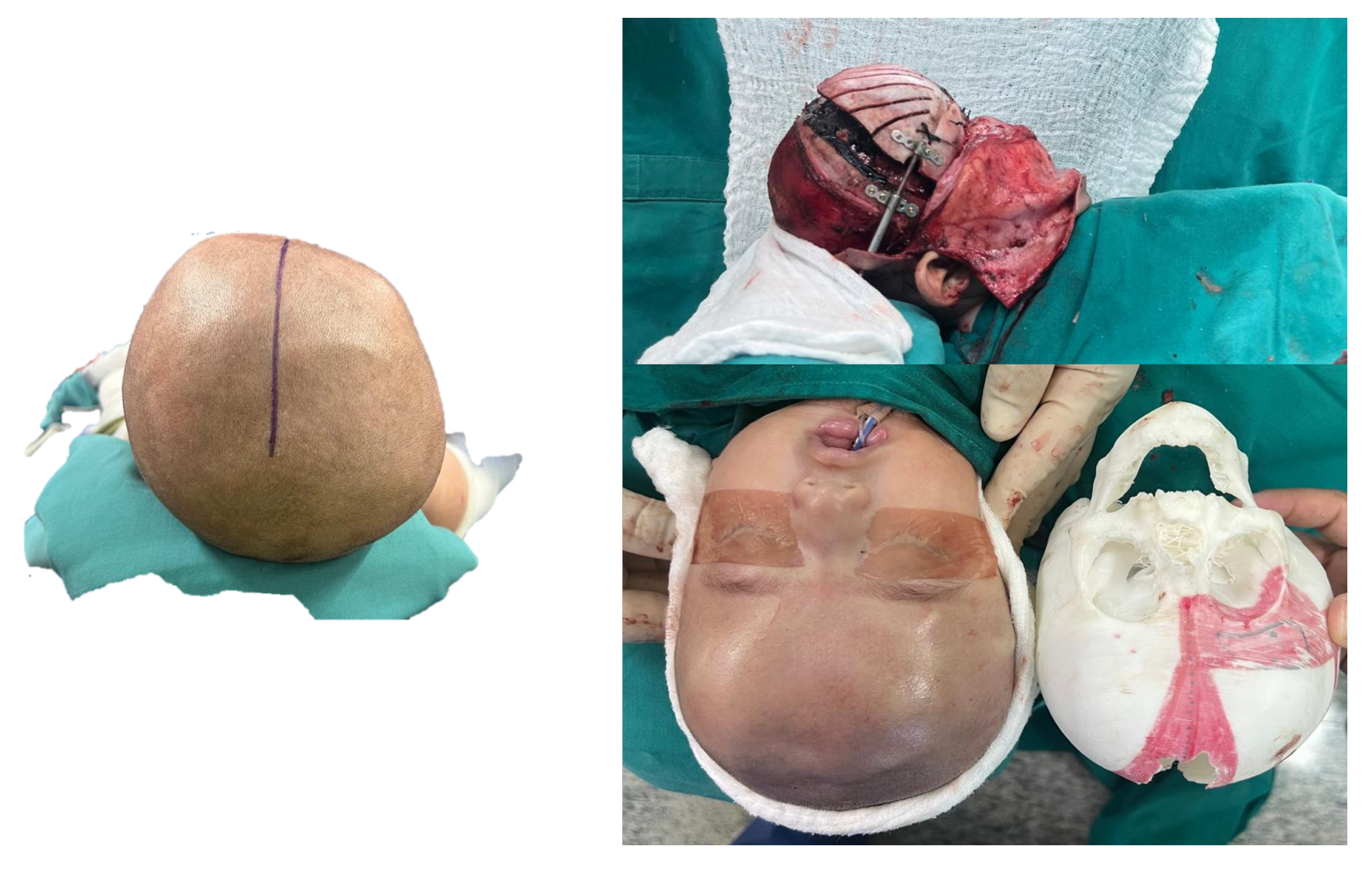 Preprints 168065 g046