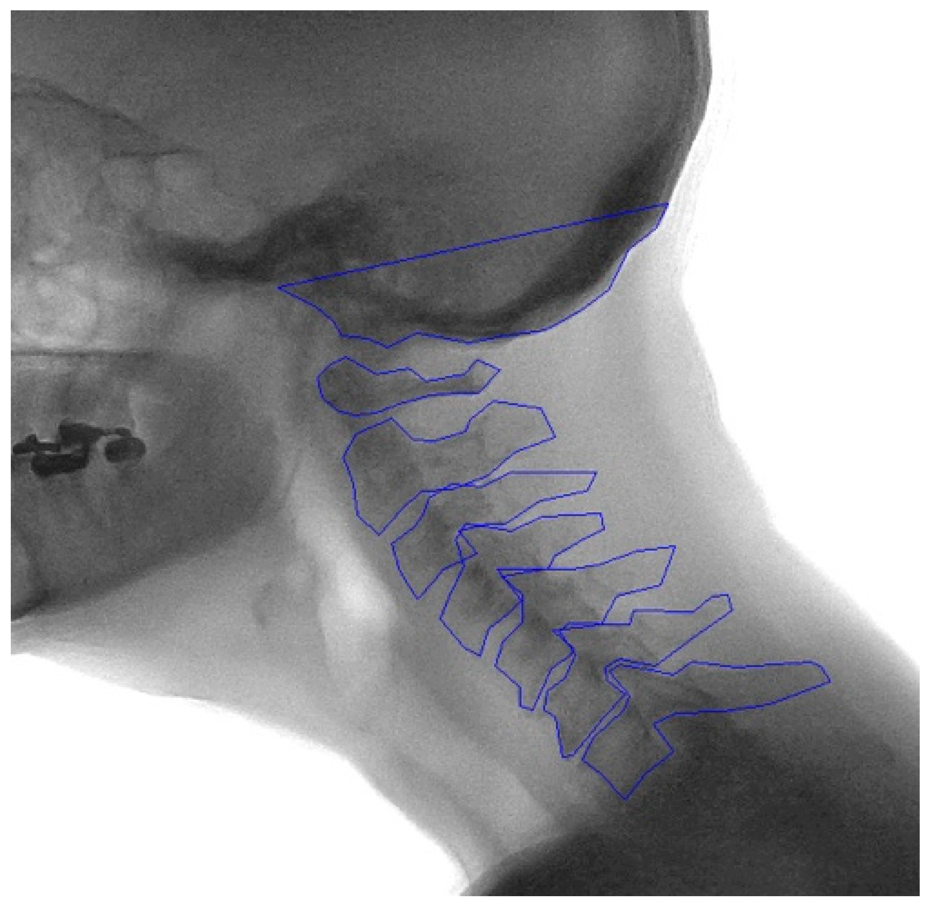 Preprints 159197 g0a1