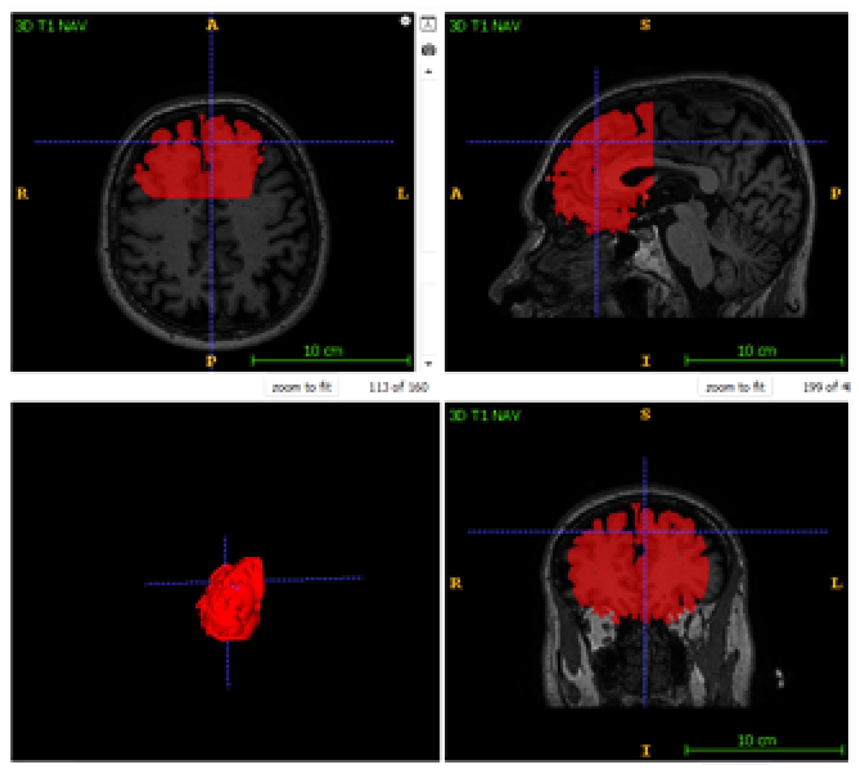Preprints 199375 g001