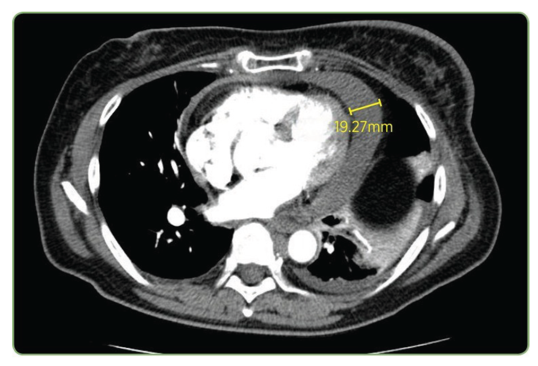 Preprints 182129 g011