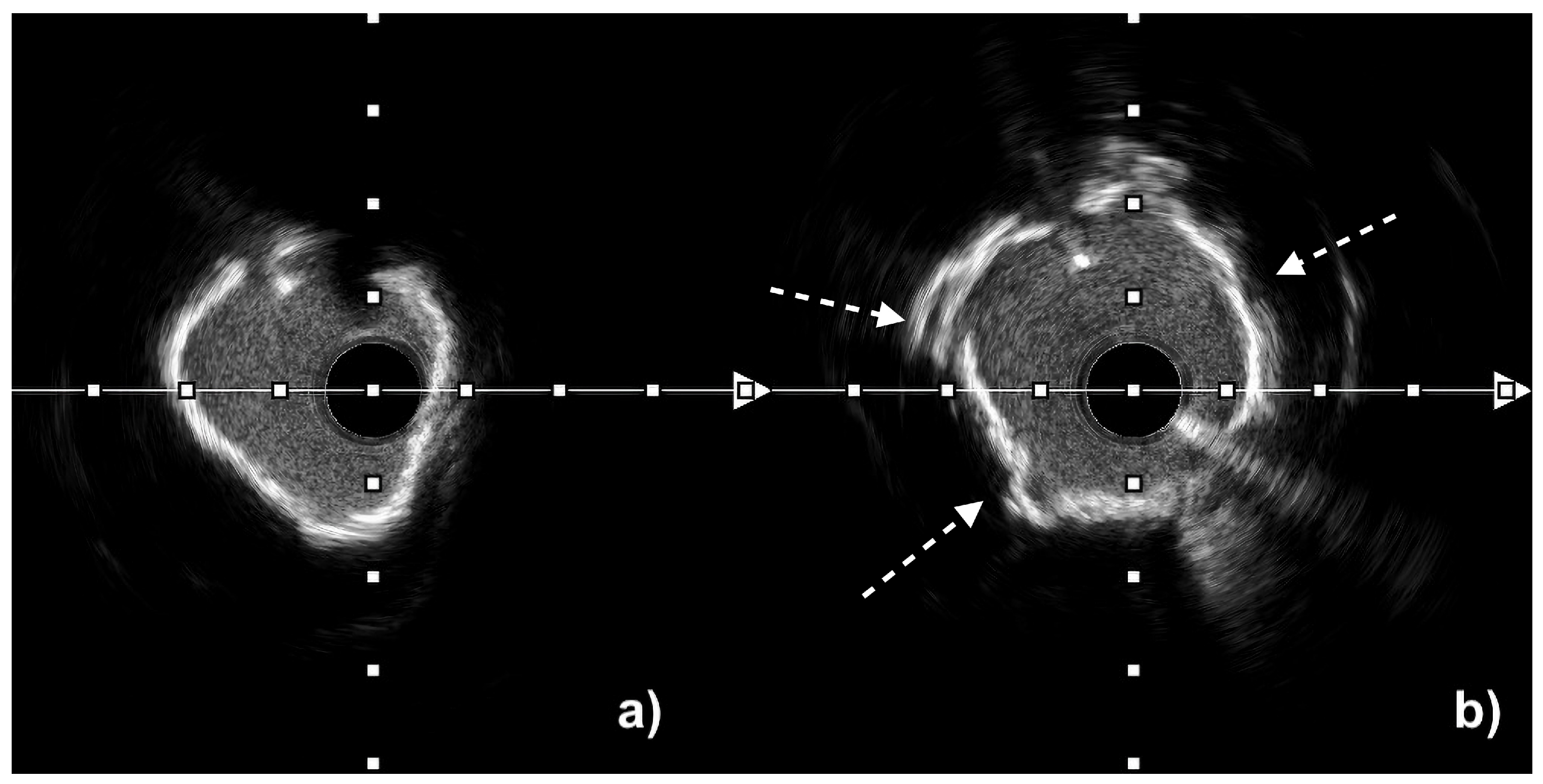 Preprints 183149 g003