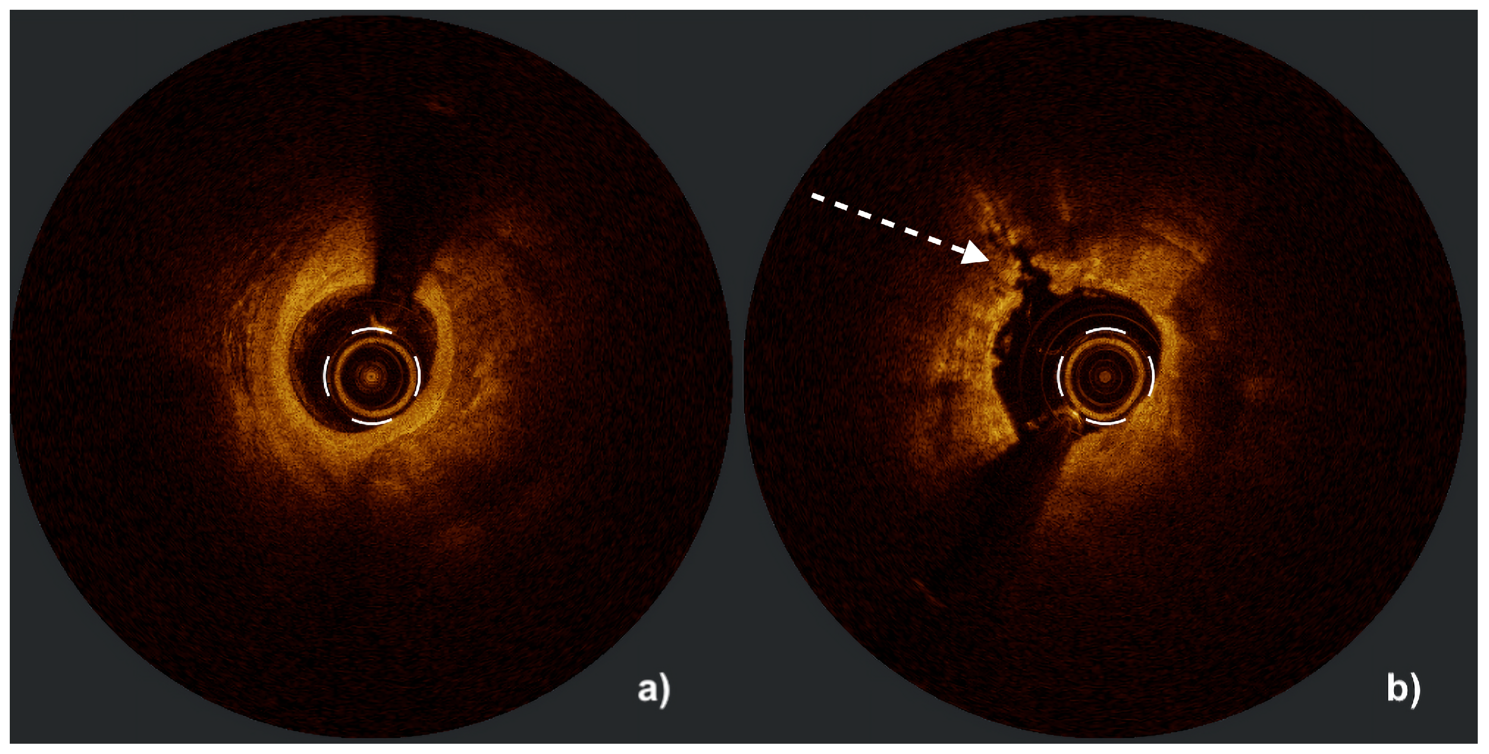 Preprints 183149 g004