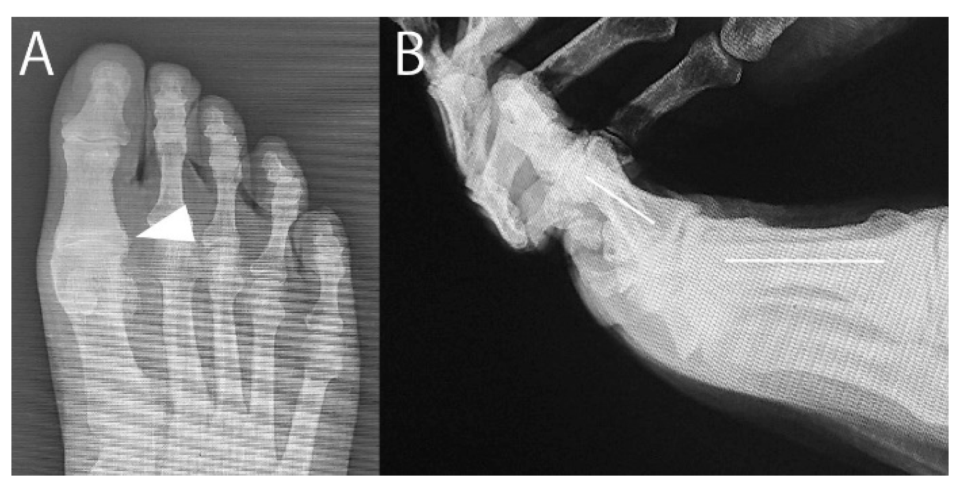 Preprints 153354 g005