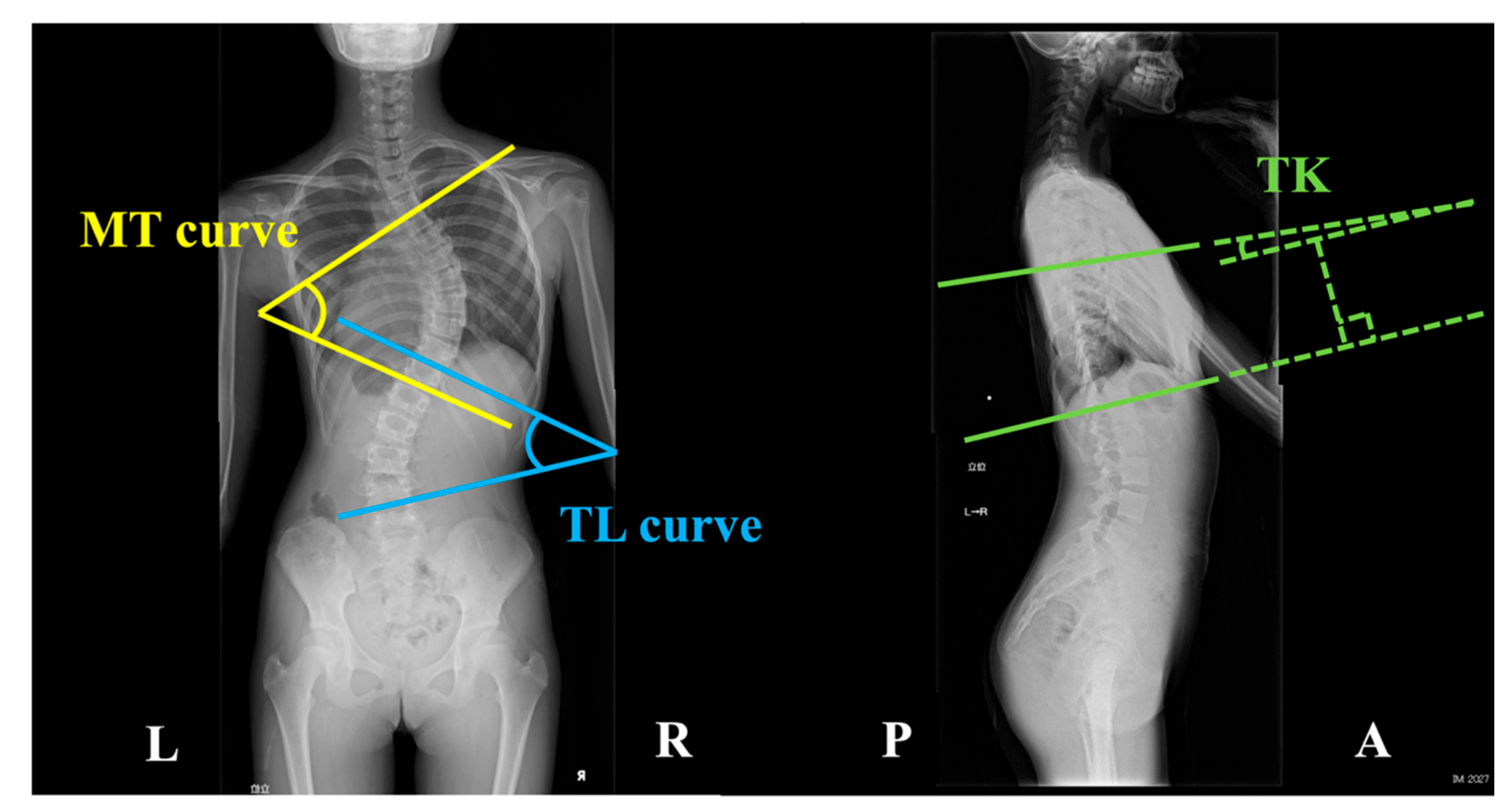 Preprints 160704 g001