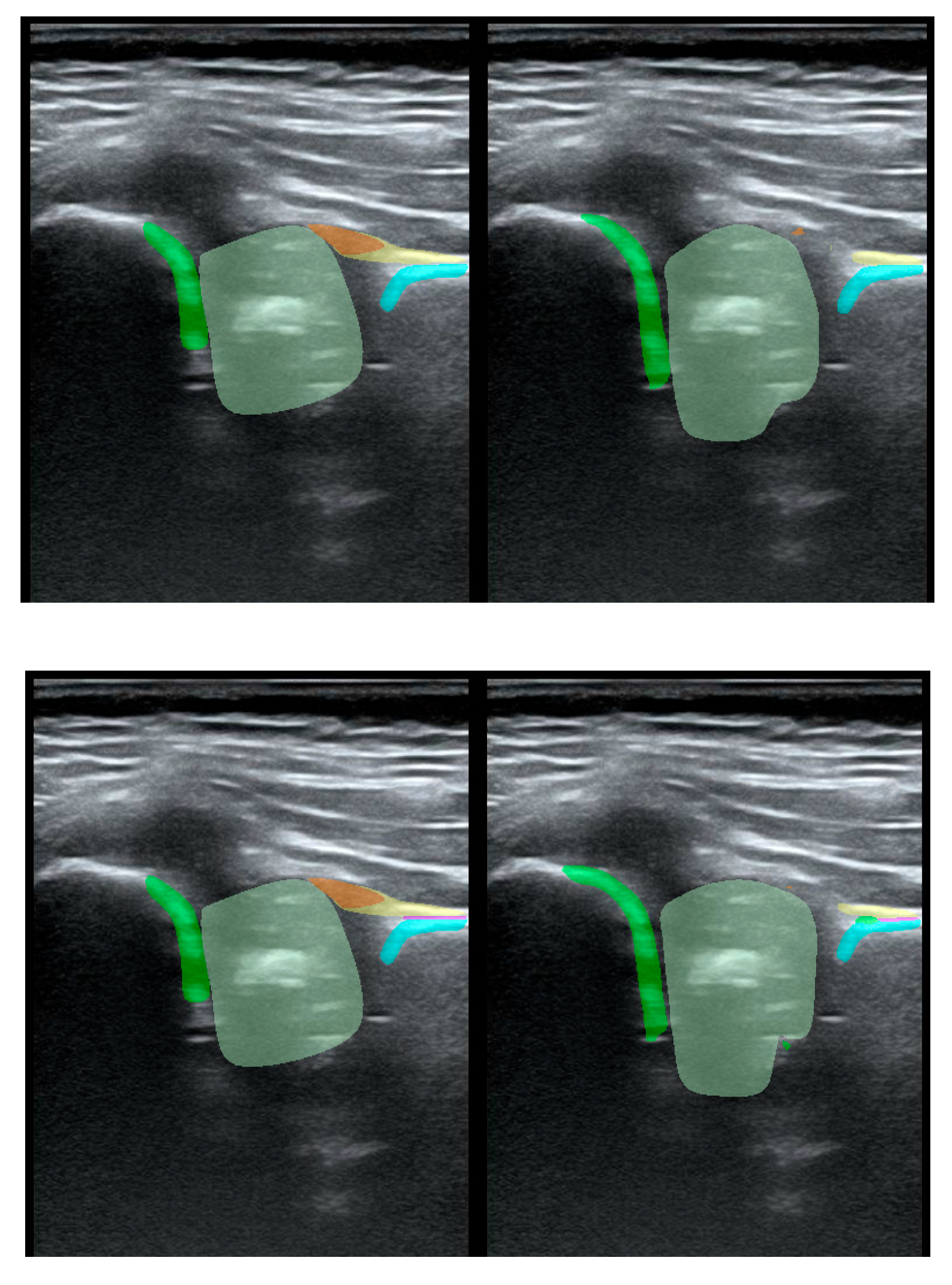 Preprints 170763 g004
