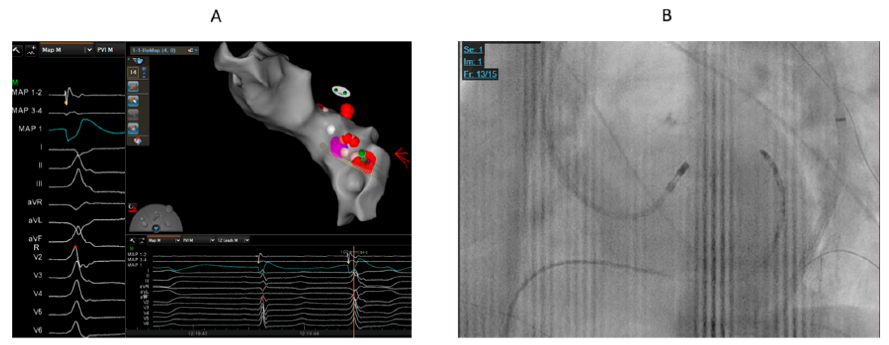 Preprints 164375 g001