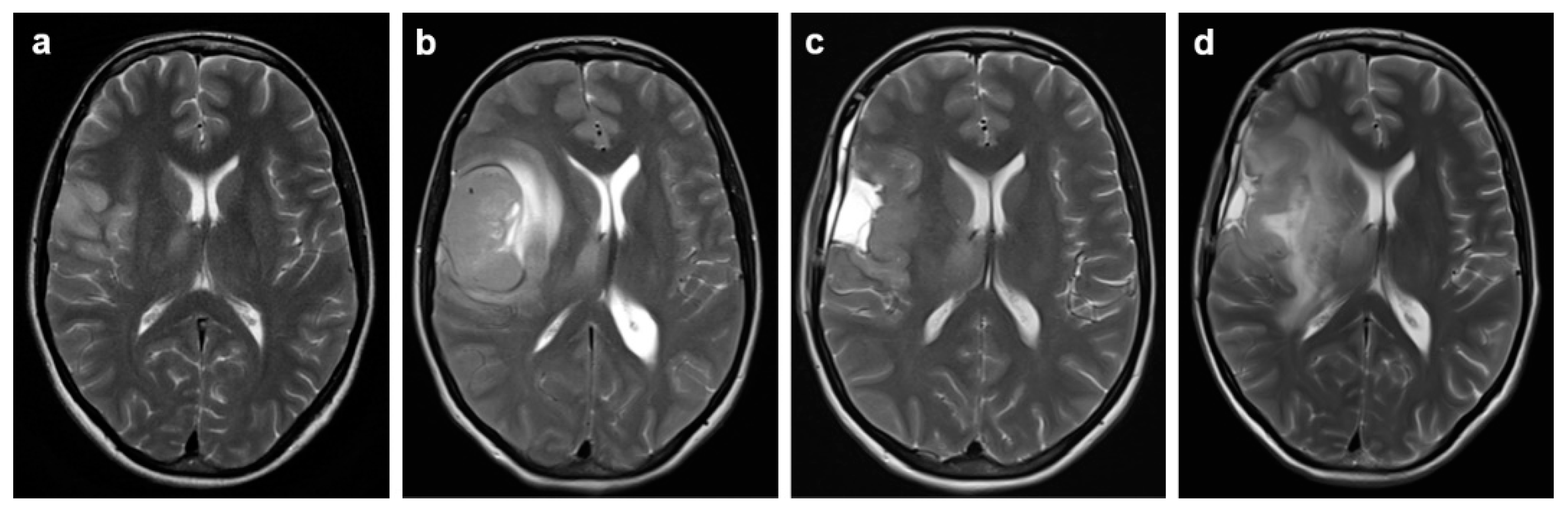 Preprints 154953 g002