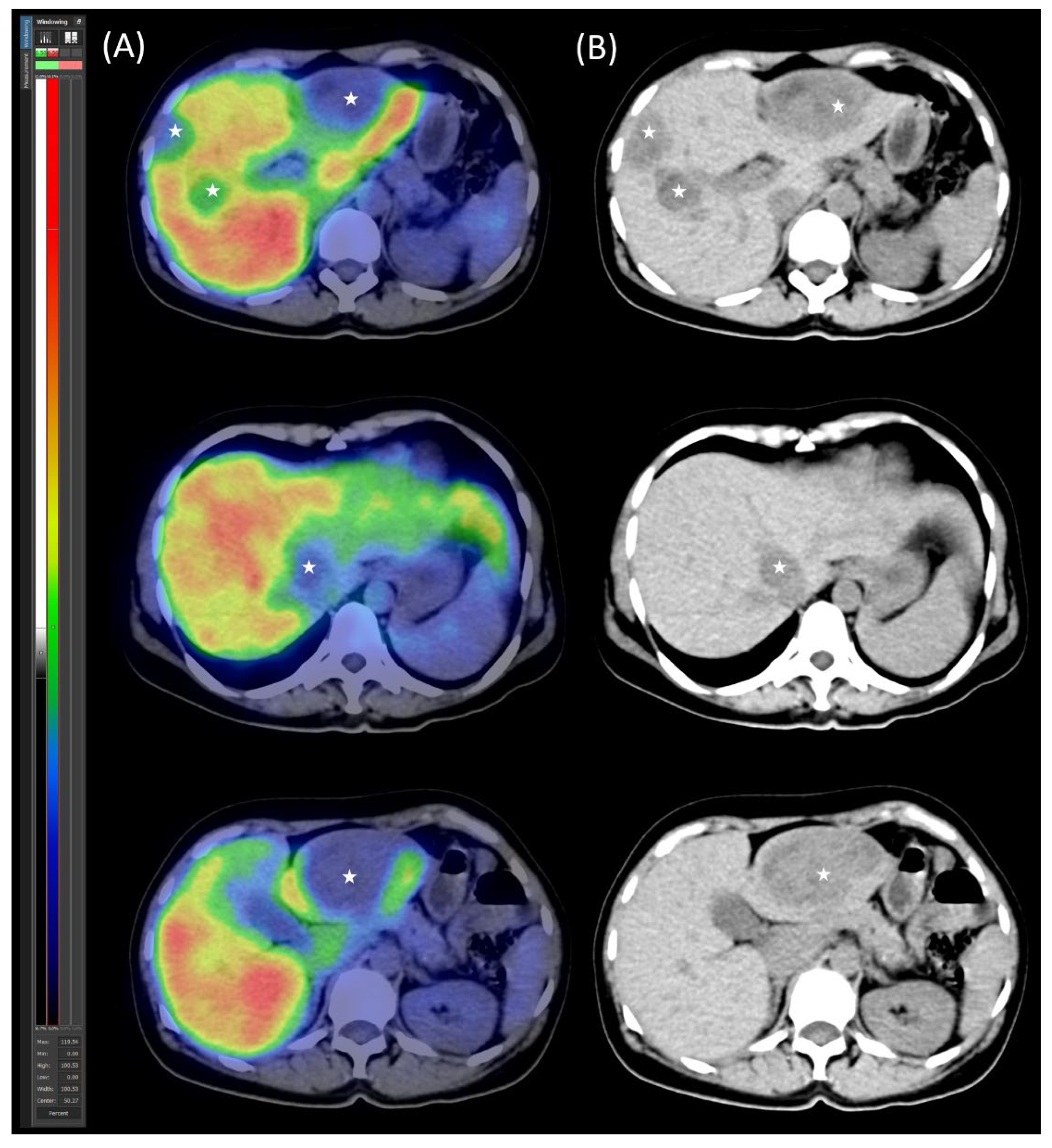 Preprints 160971 g002