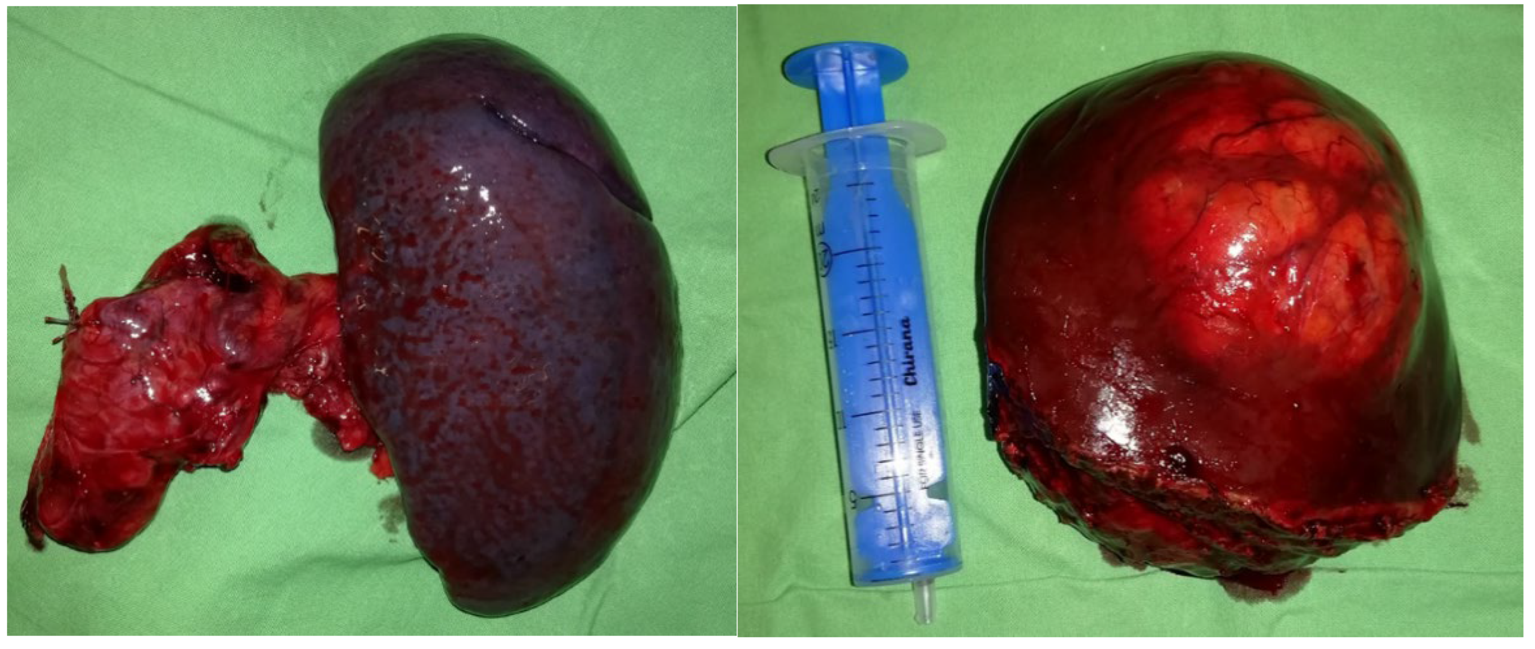 Preprints 160971 g003