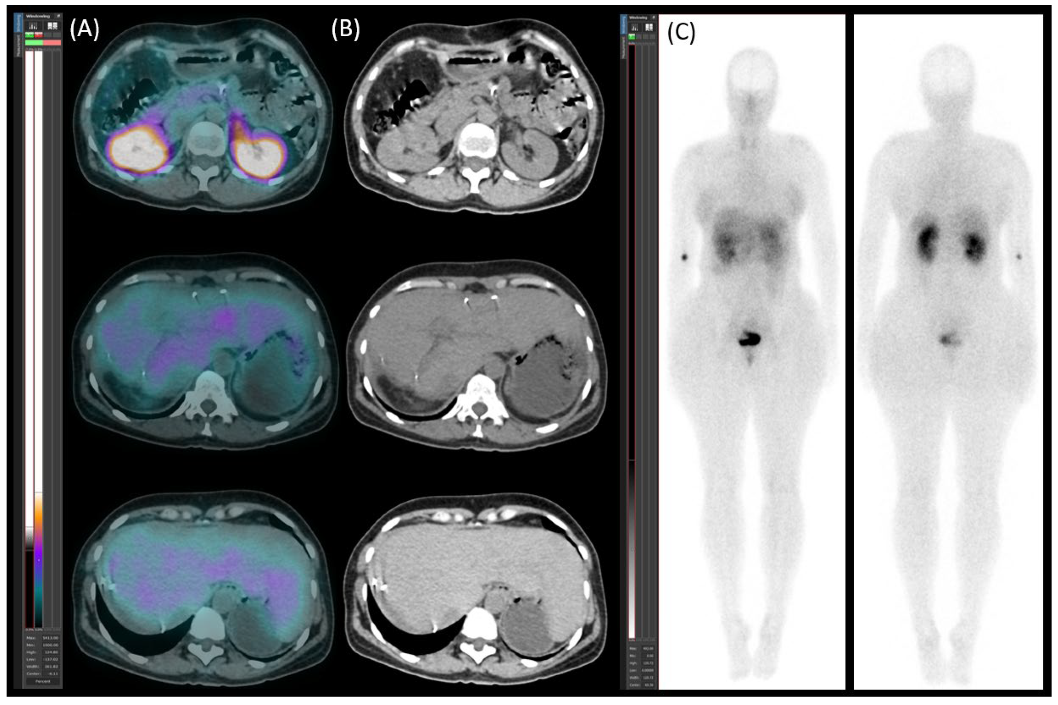 Preprints 160971 g006