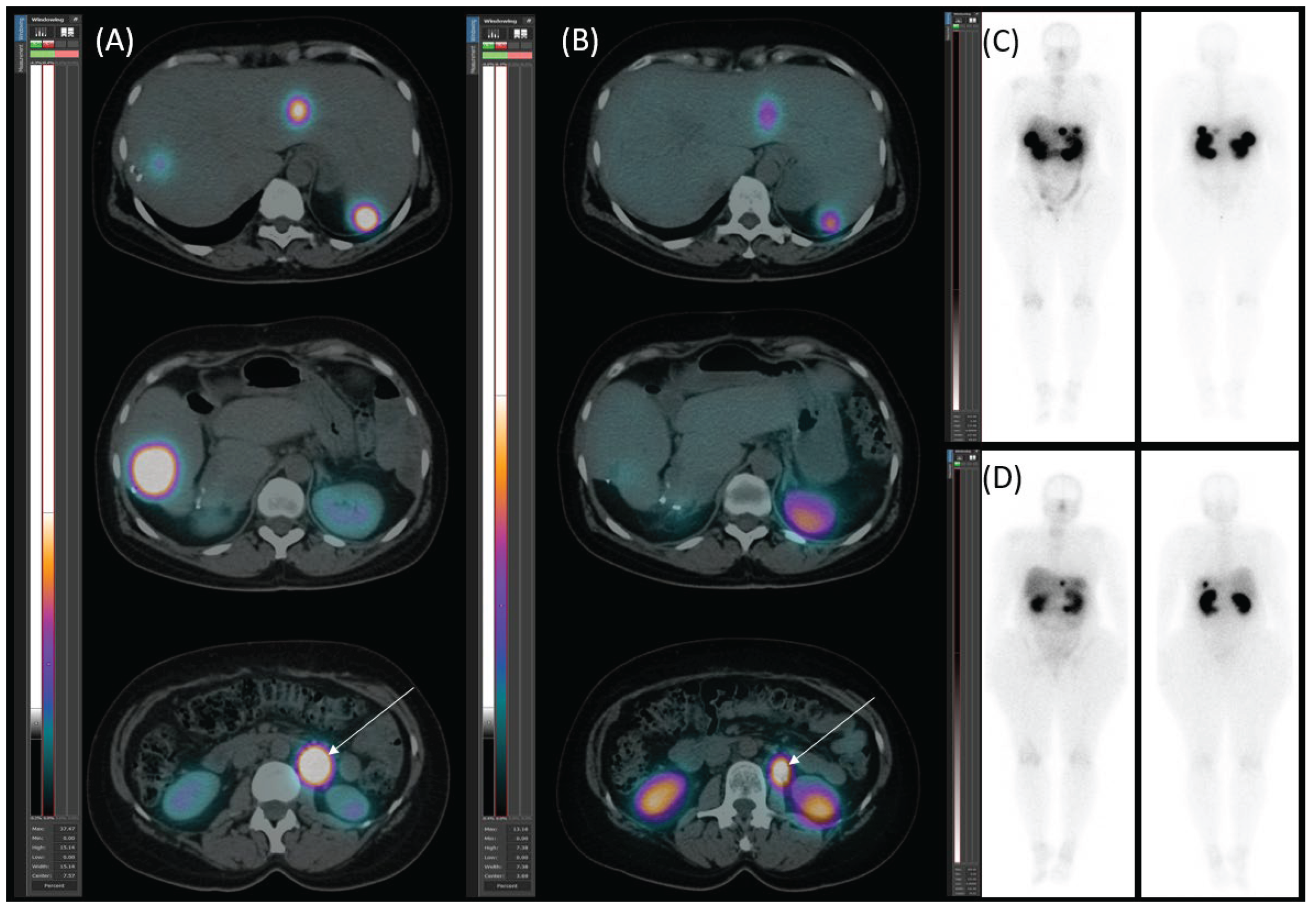 Preprints 160971 g008