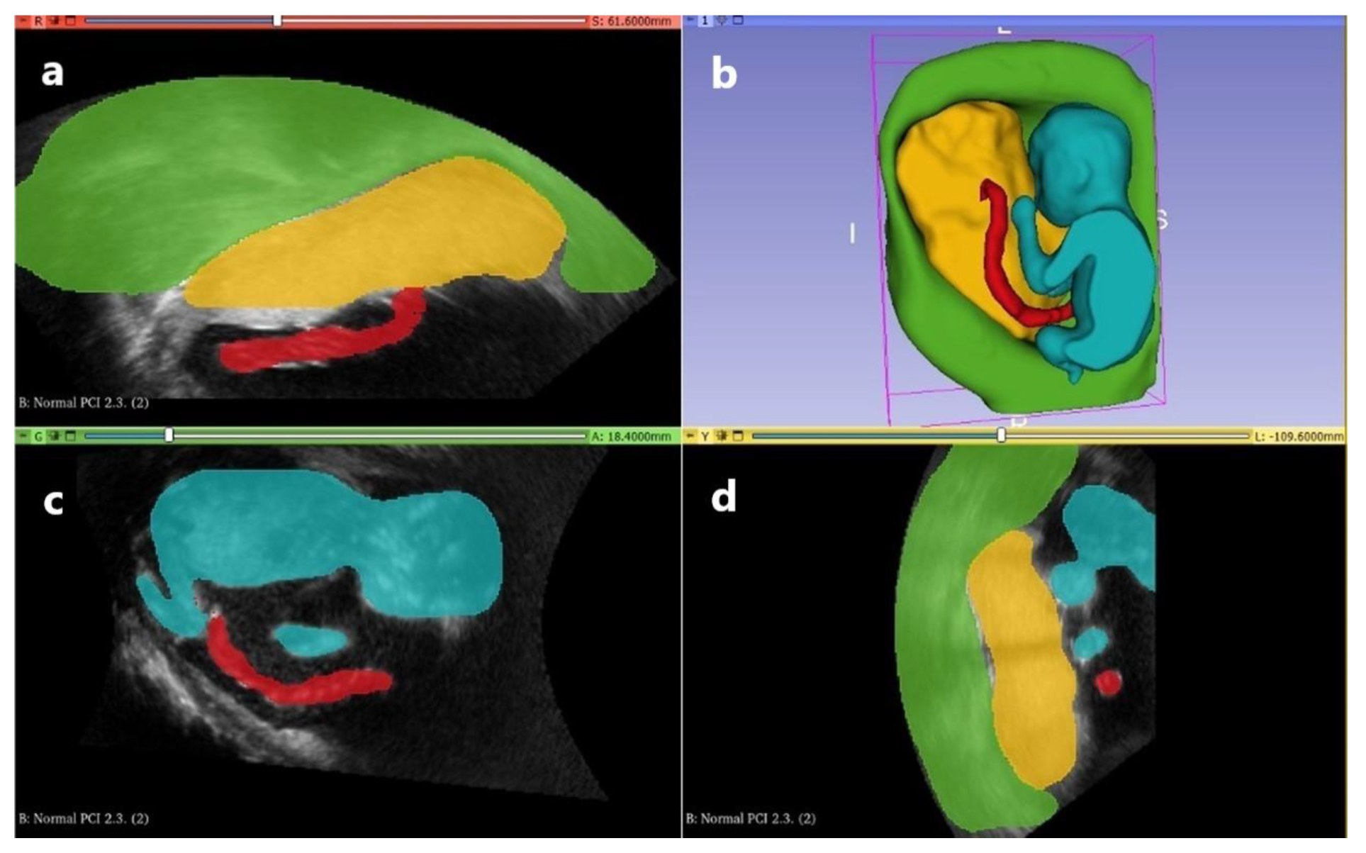 Preprints 164908 g002