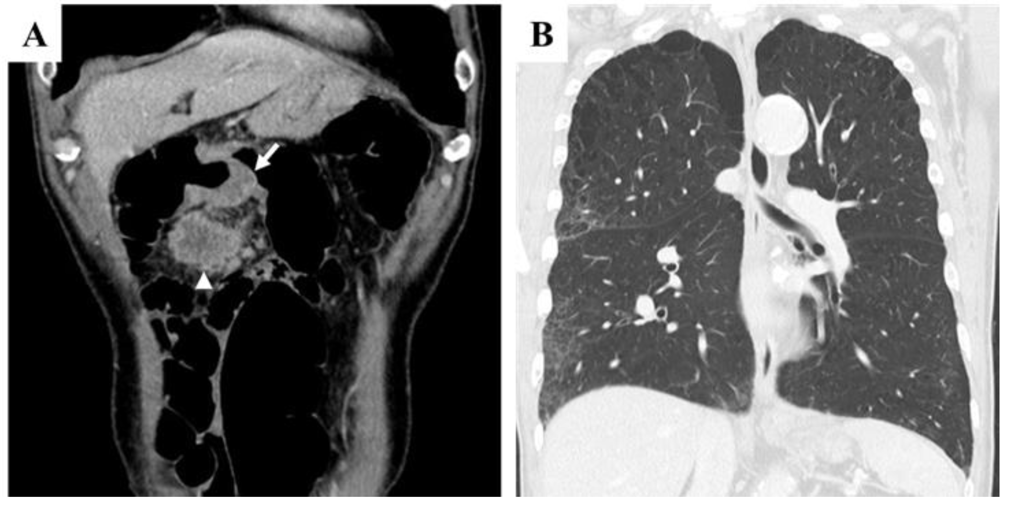 Preprints 170343 g001