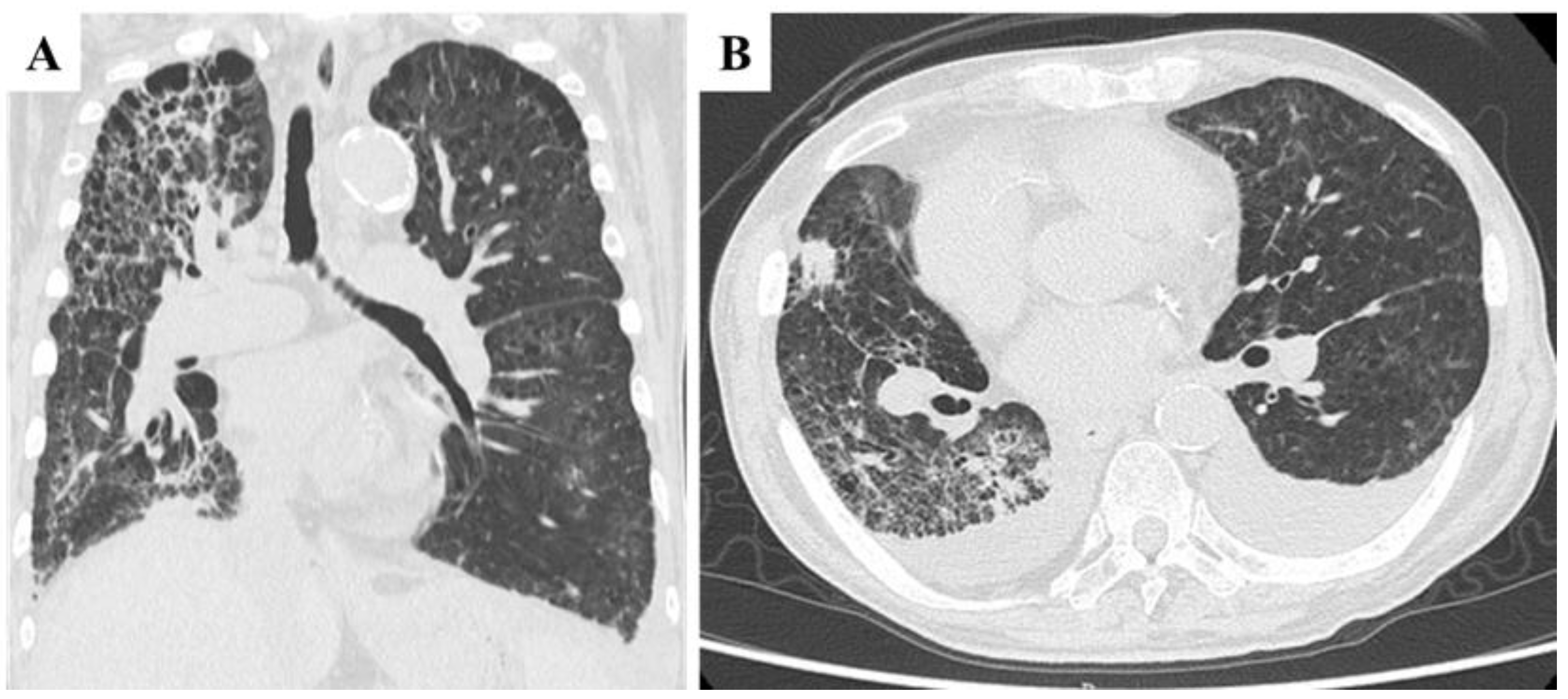 Preprints 170343 g003
