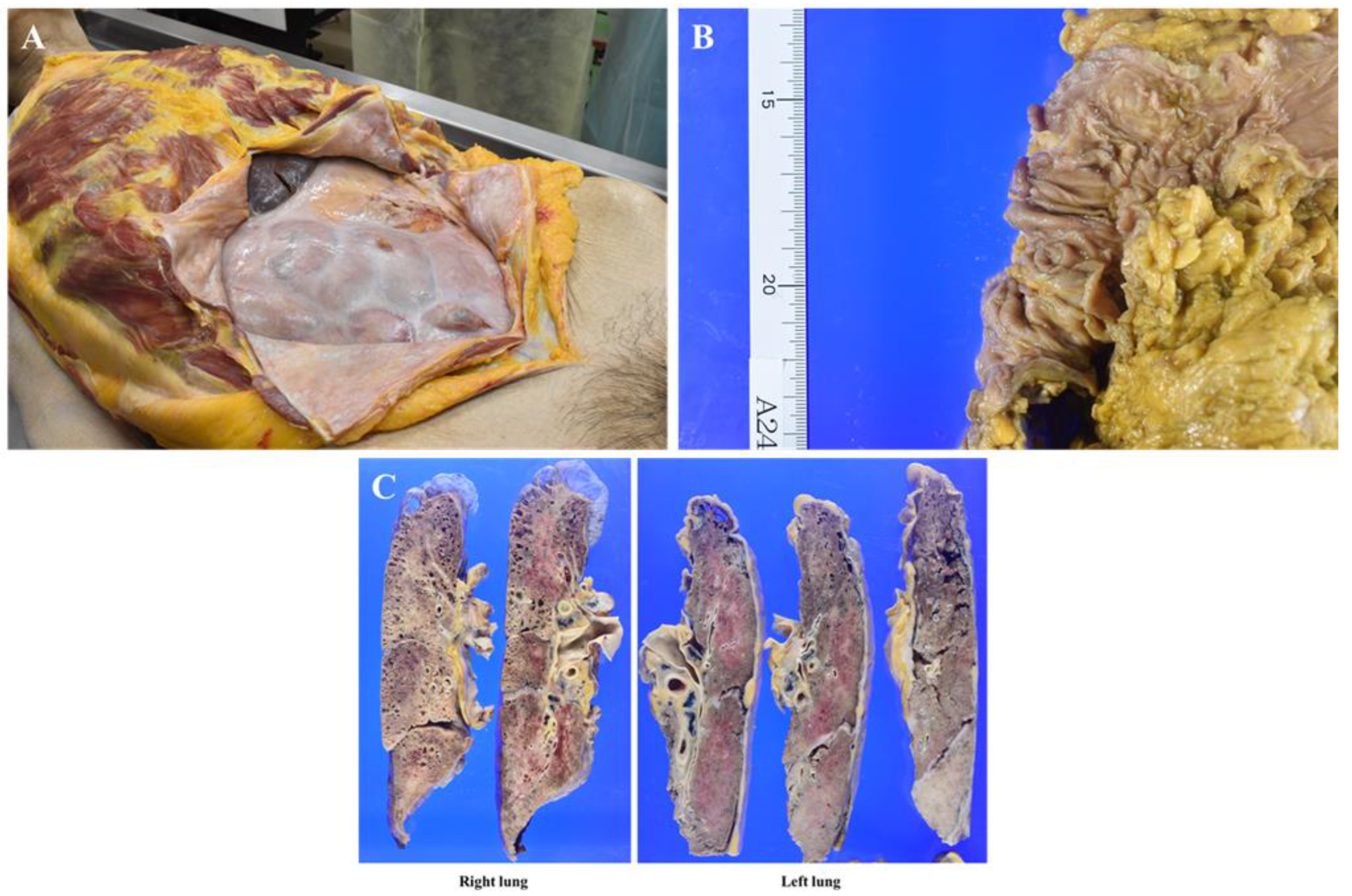 Preprints 170343 g004