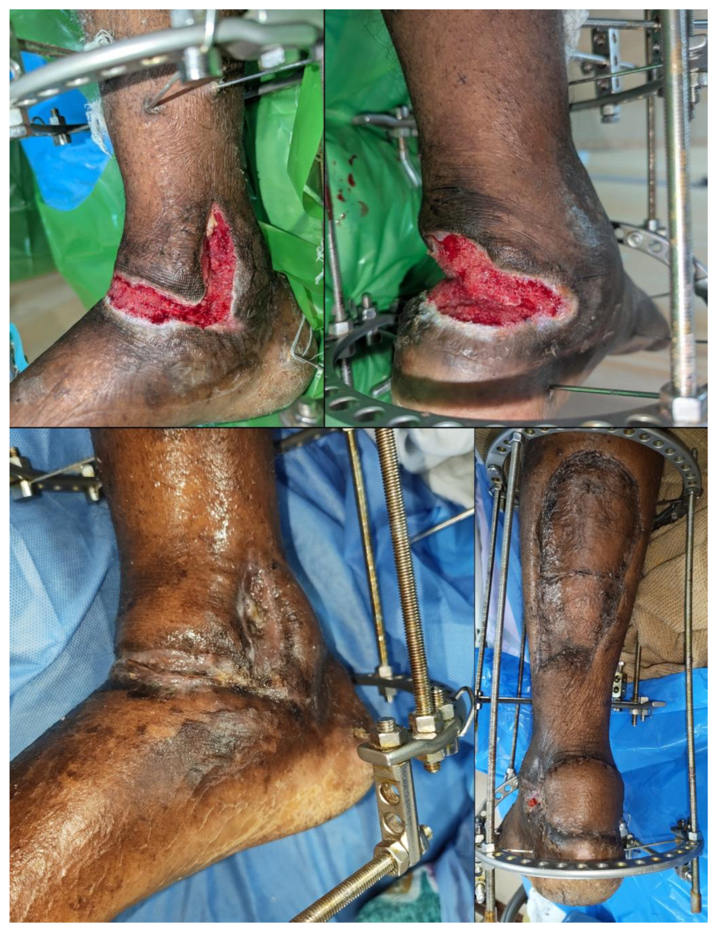 Preprints 193168 g005