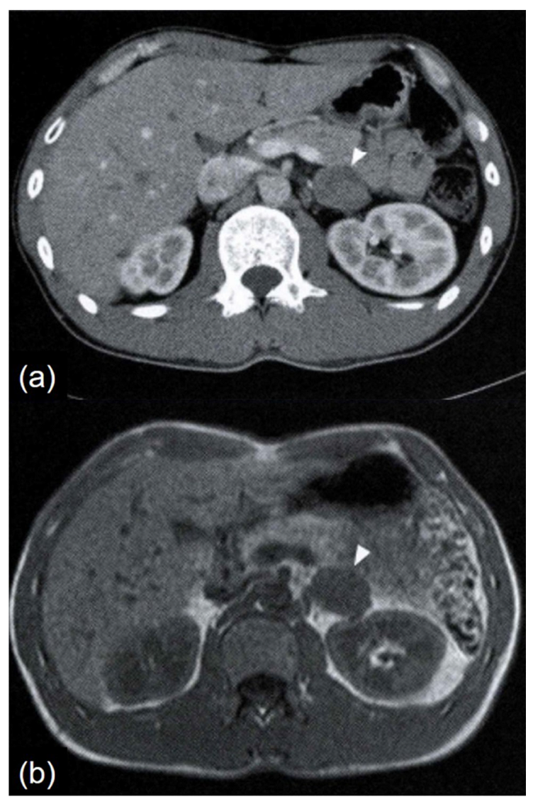 Preprints 170710 g001