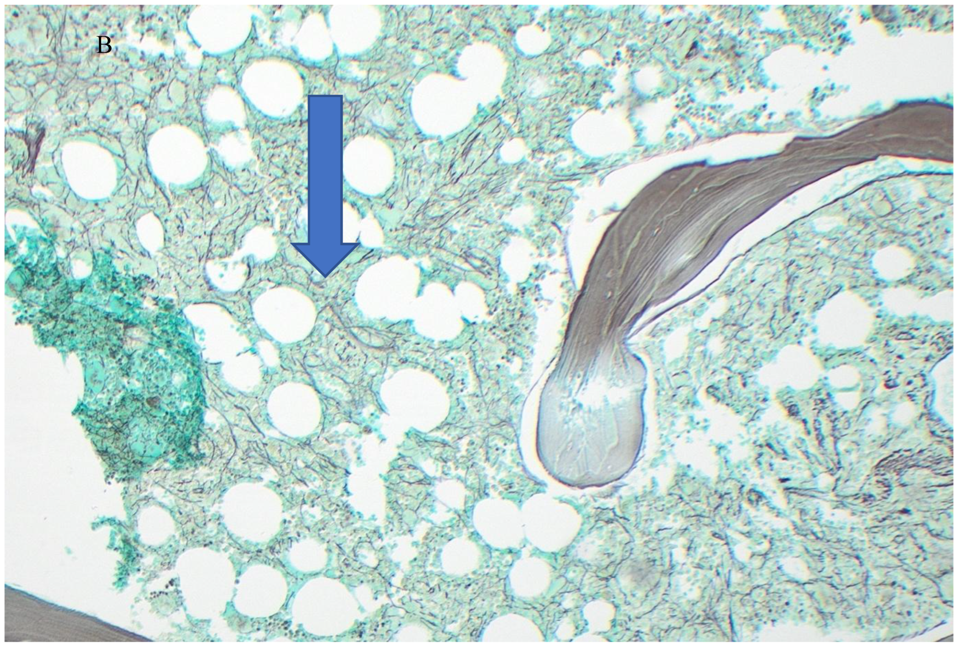 Preprints 182045 g002b