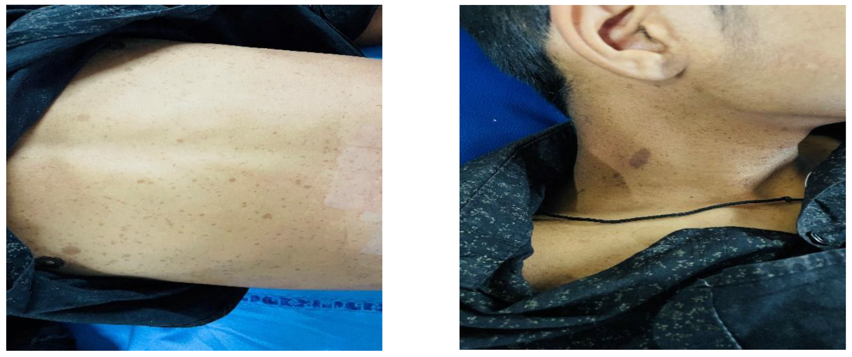 Preprints 165557 g002