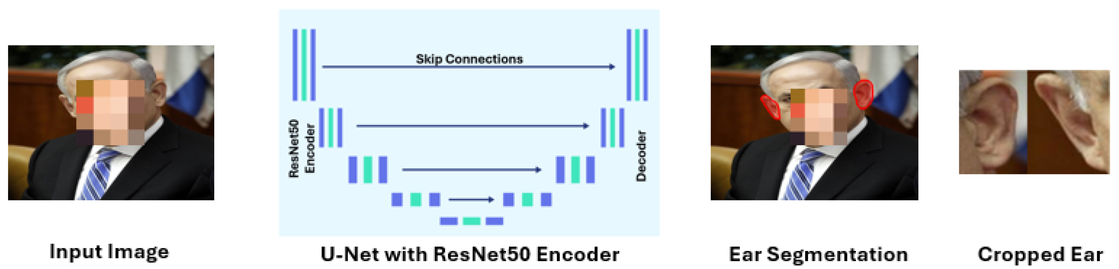 End-to-End Pixel-Wise Ear Segmentation with U-Net and ResNet-50 Encoder ...