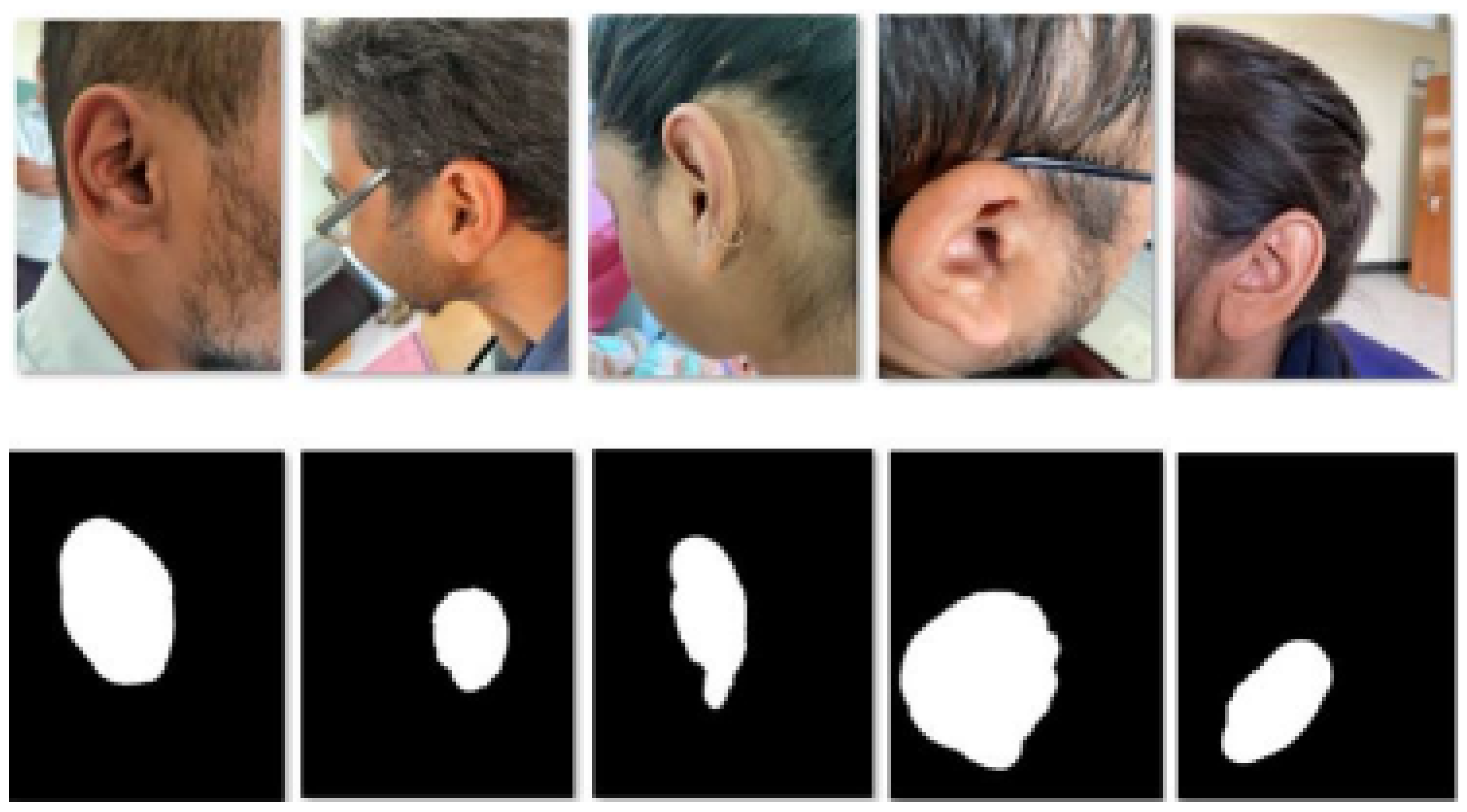 End-to-End Pixel-Wise Ear Segmentation with U-Net and ResNet-50 Encoder ...