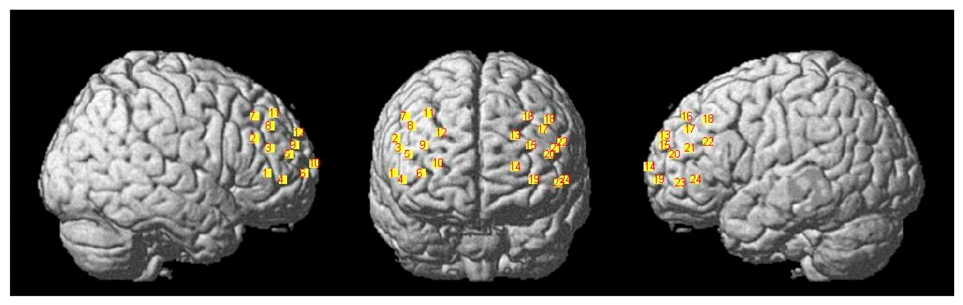 Preprints 145834 g005