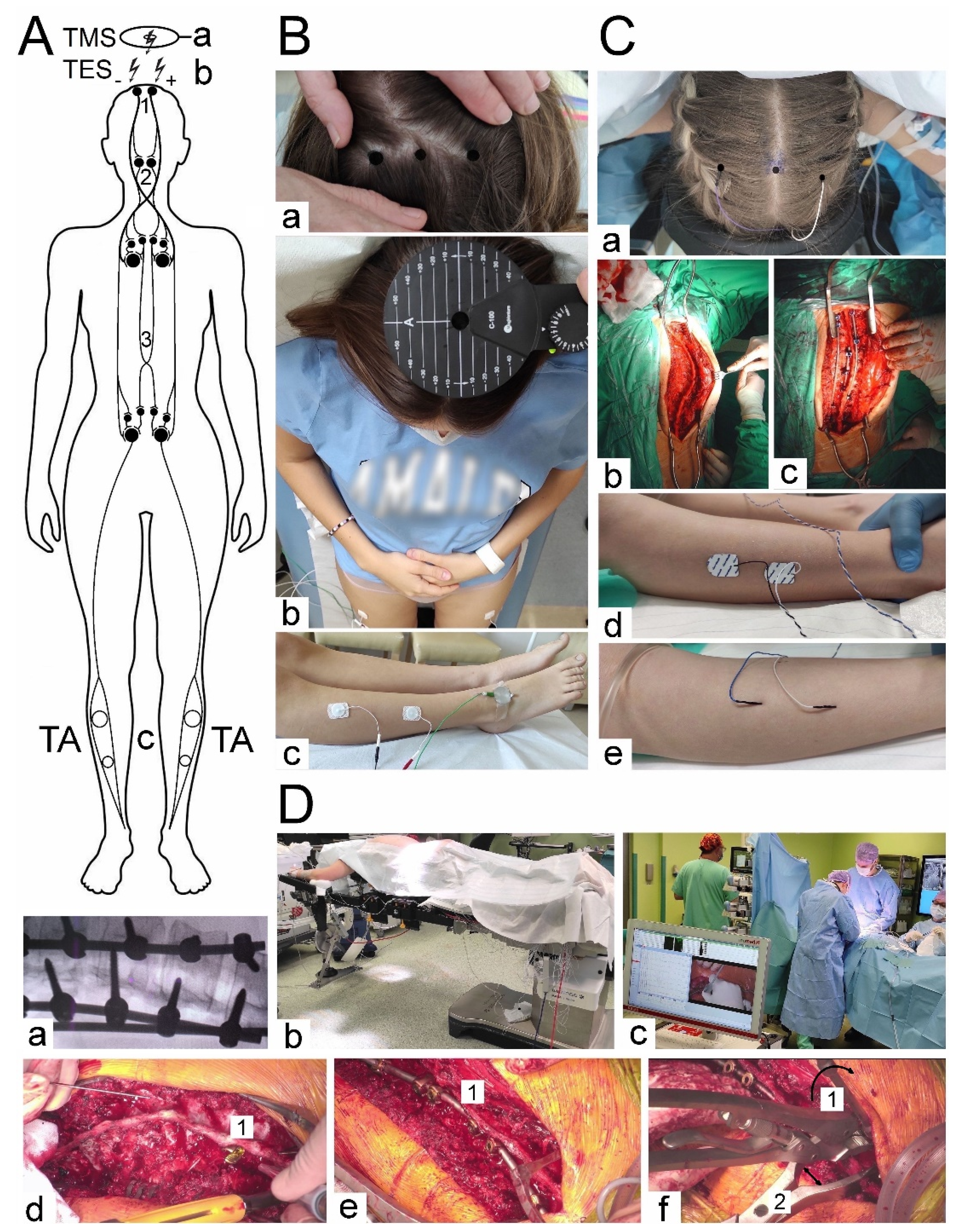 Preprints 81619 g001