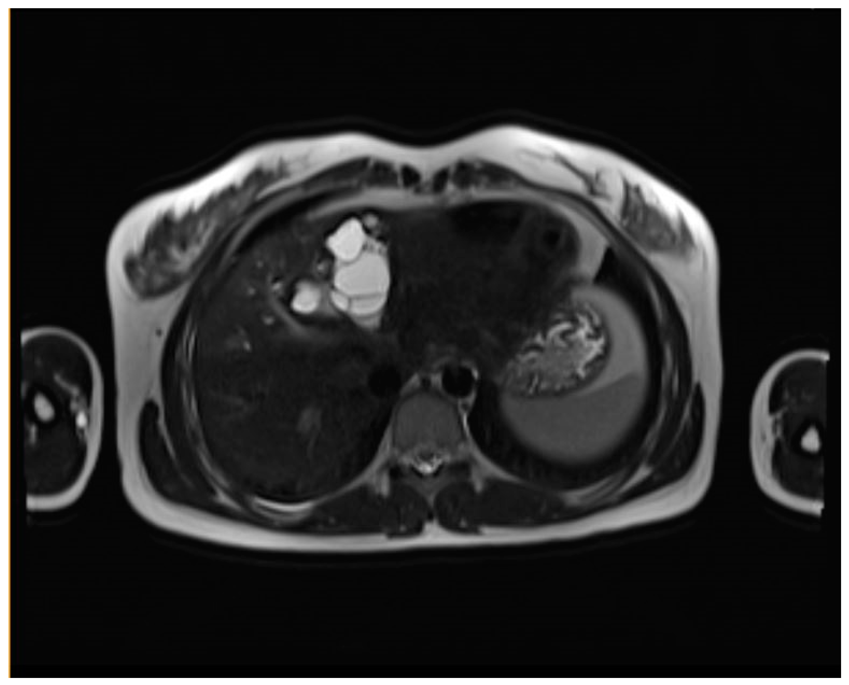 Preprints 151126 g001