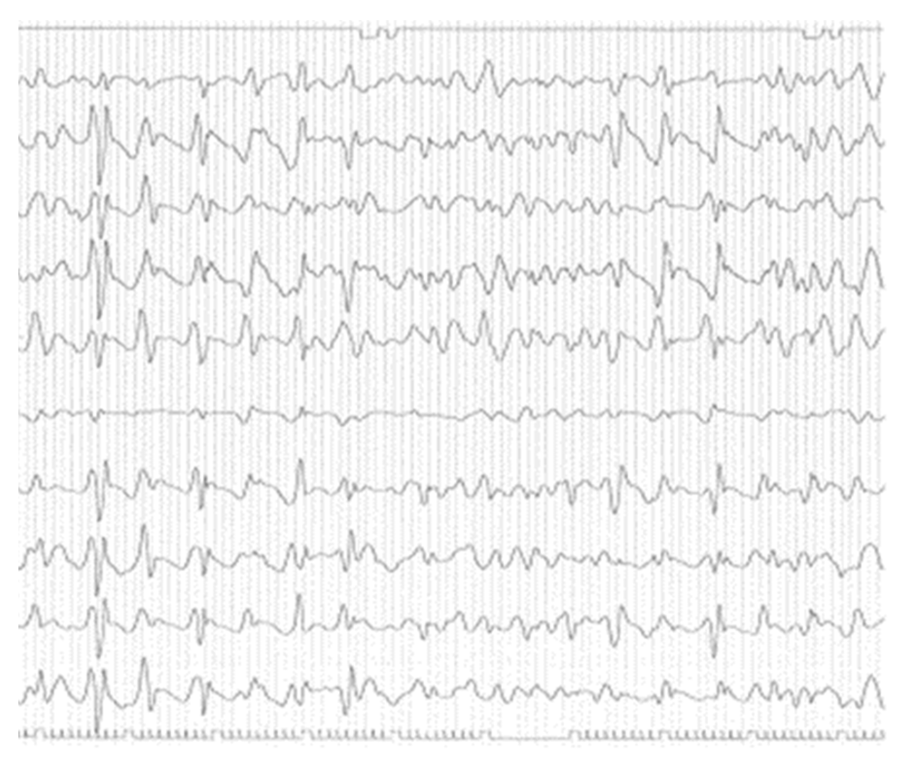 Preprints 94065 g001