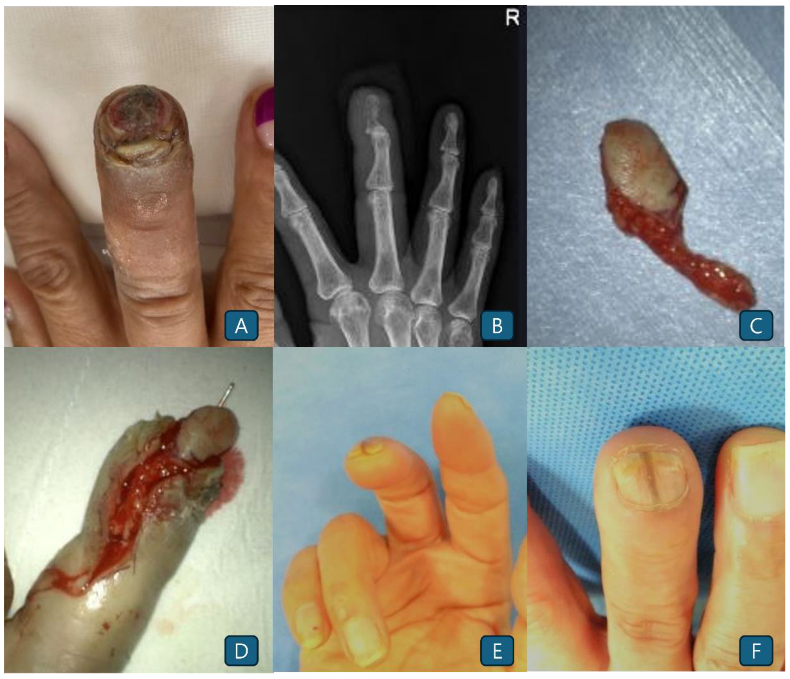 Preprints 168297 g002