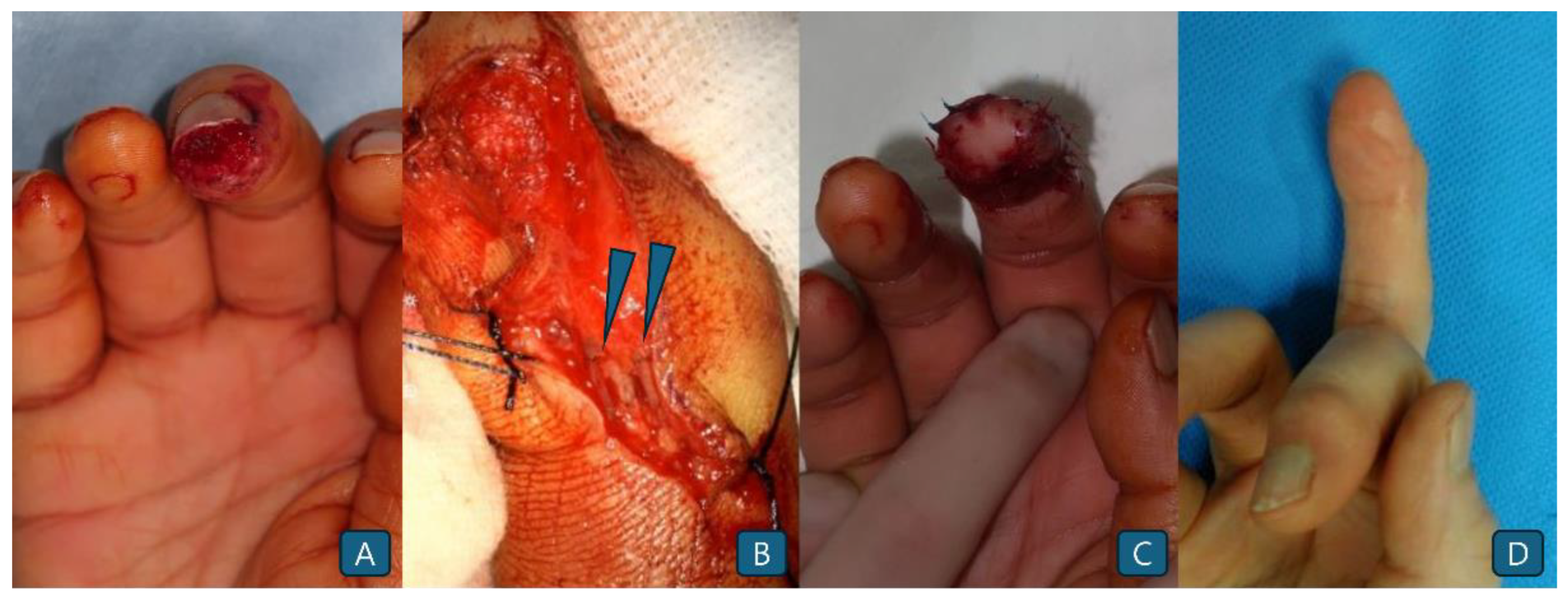 Preprints 168297 g003