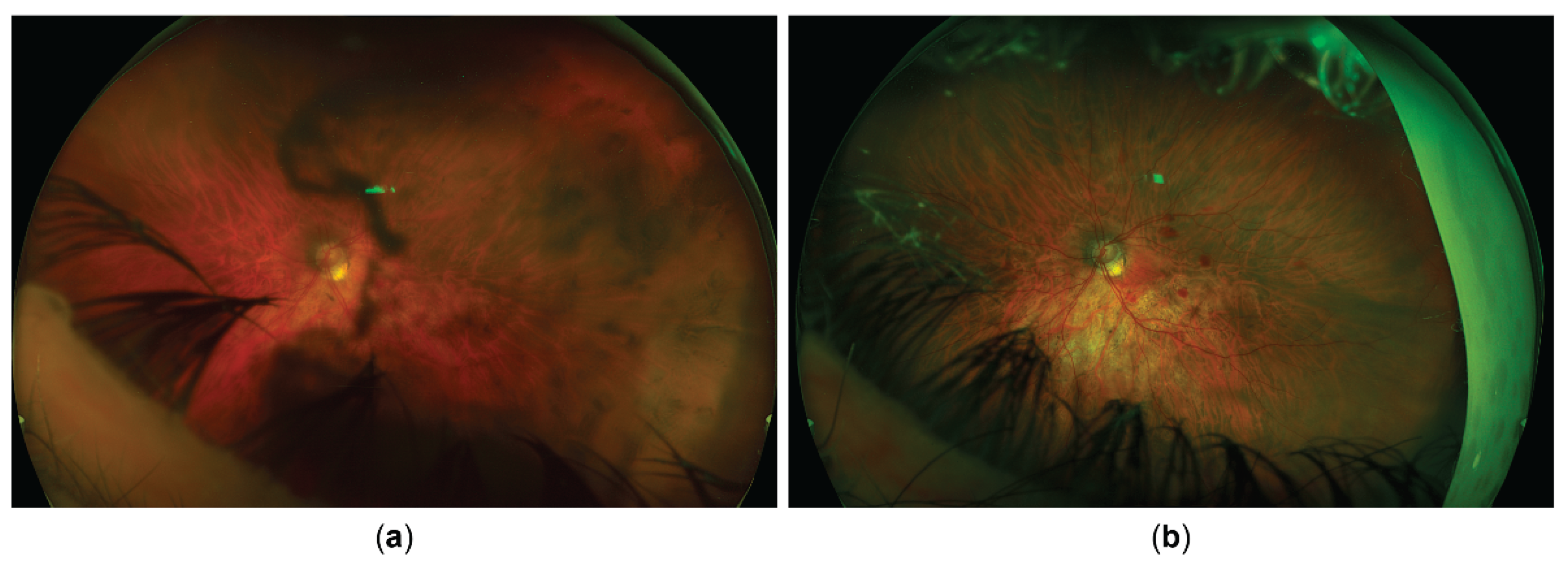 Preprints 162242 g005