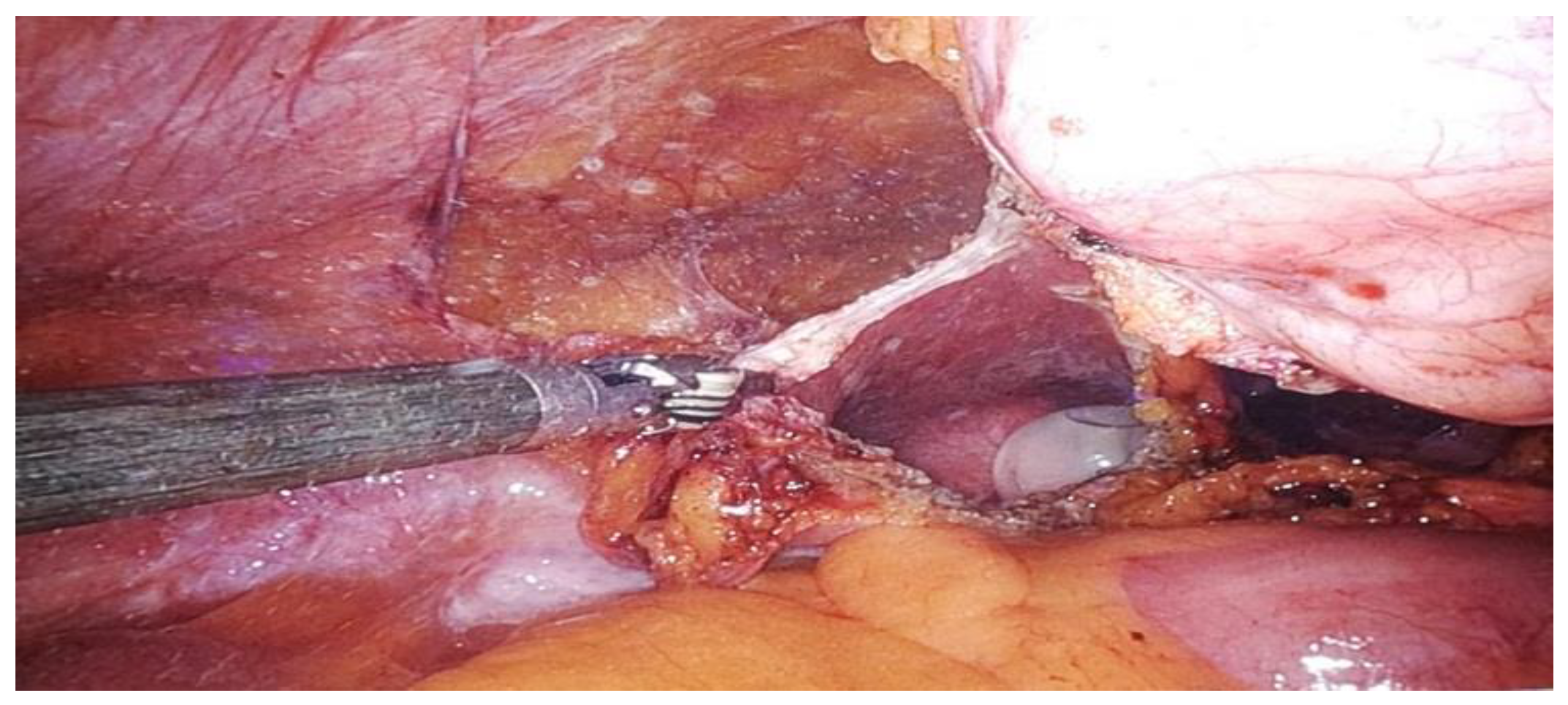 Preprints 146094 g003