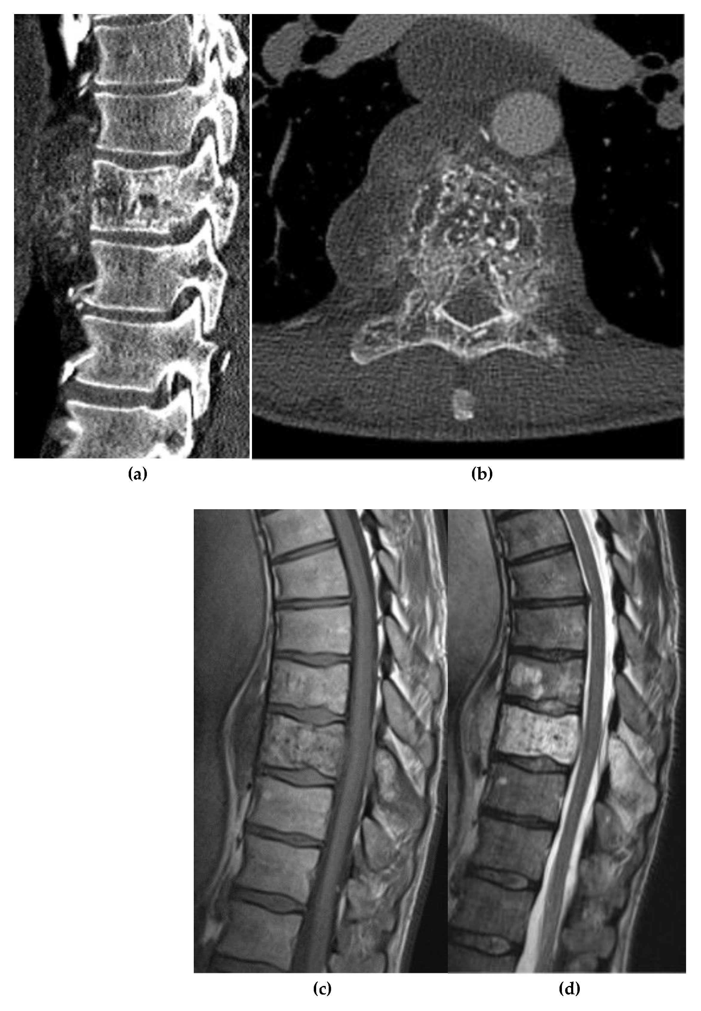 Preprints 180579 g017a