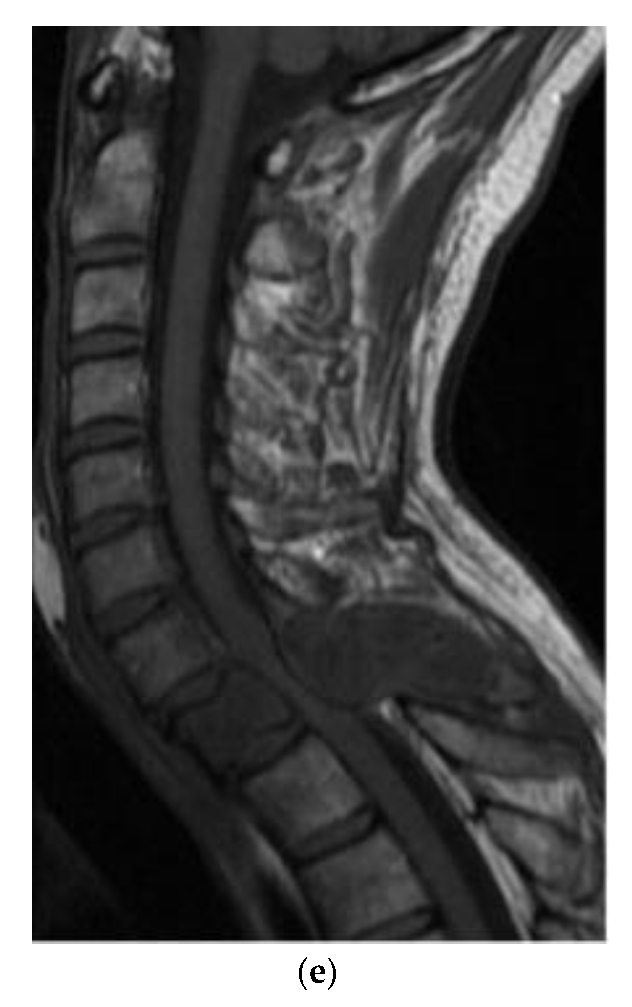 Preprints 180579 g020b